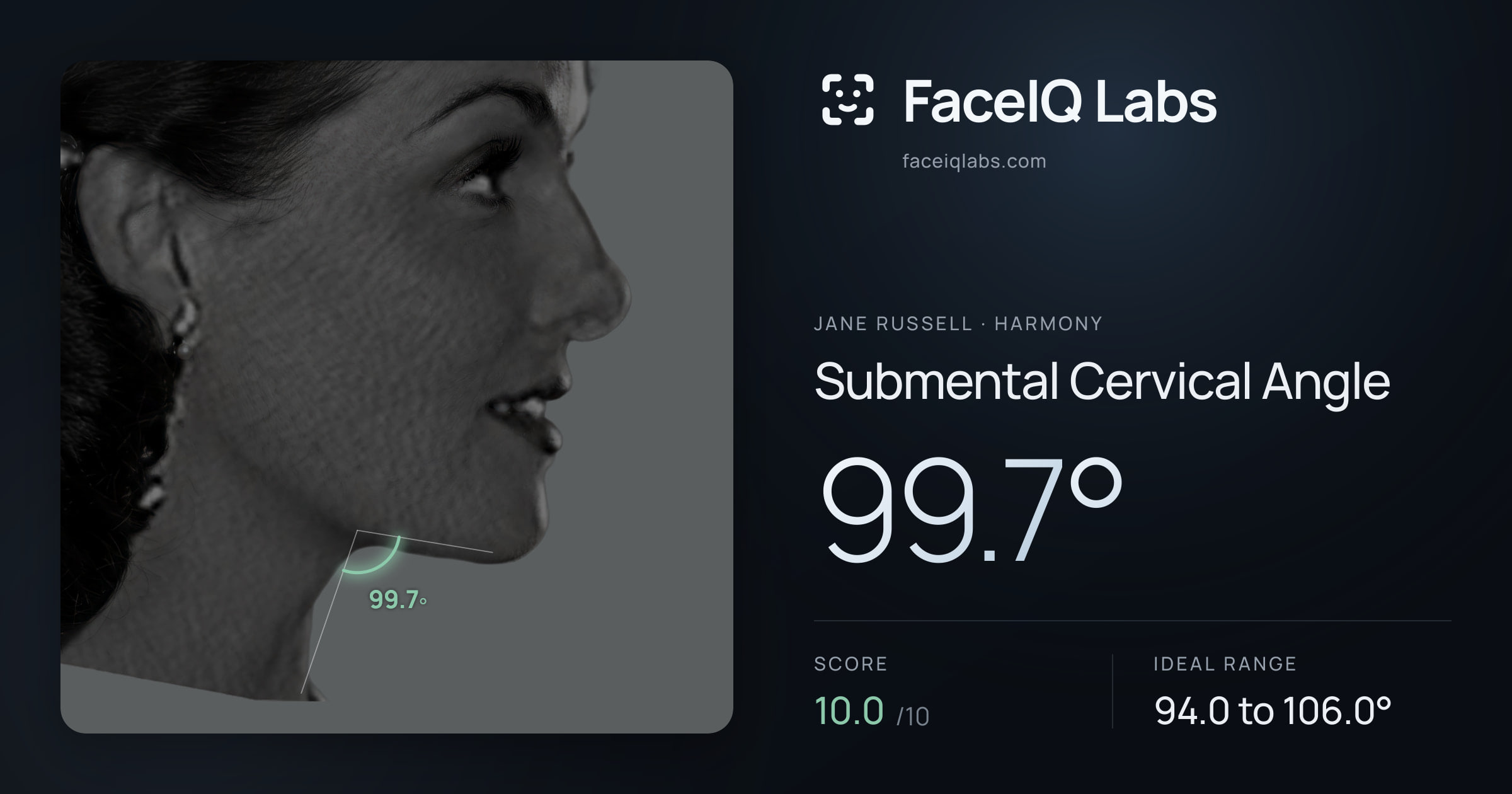 Jane Russell Submental Cervical Angle: 99.7°, drawn on the photo