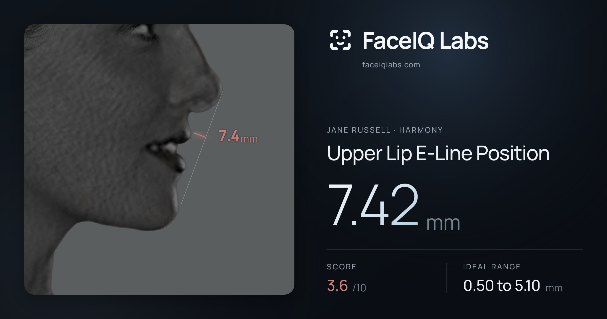 Jane Russell Upper Lip E-Line Position: 7.42mm, drawn on the photo