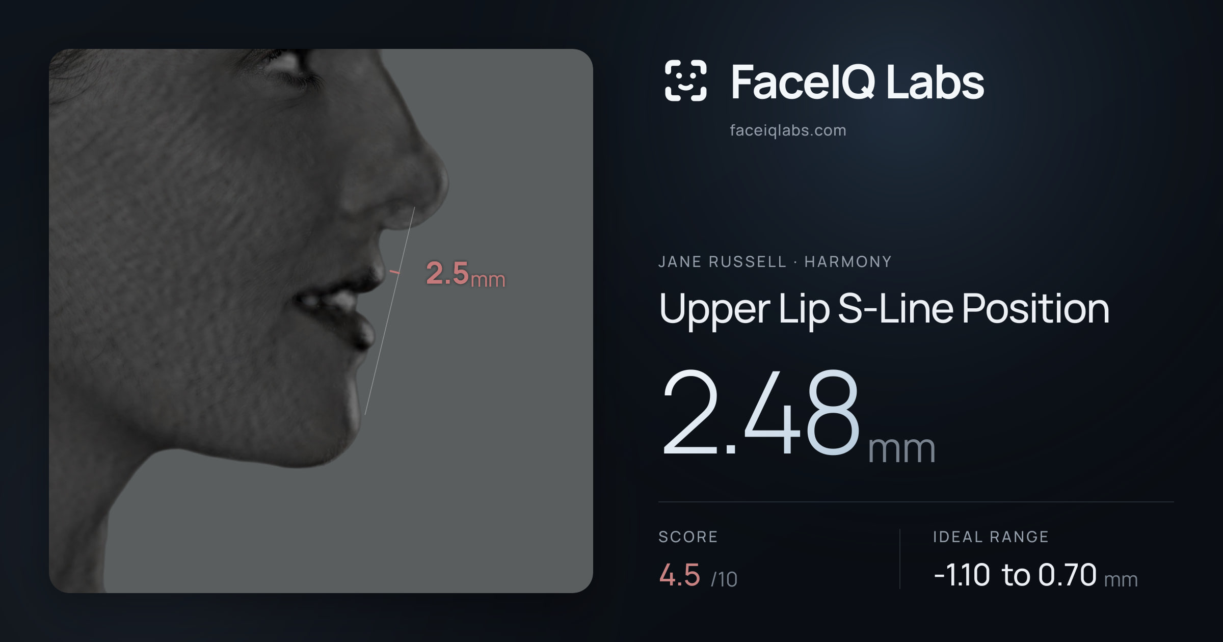 Jane Russell Upper Lip S-Line Position: 2.48mm, drawn on the photo