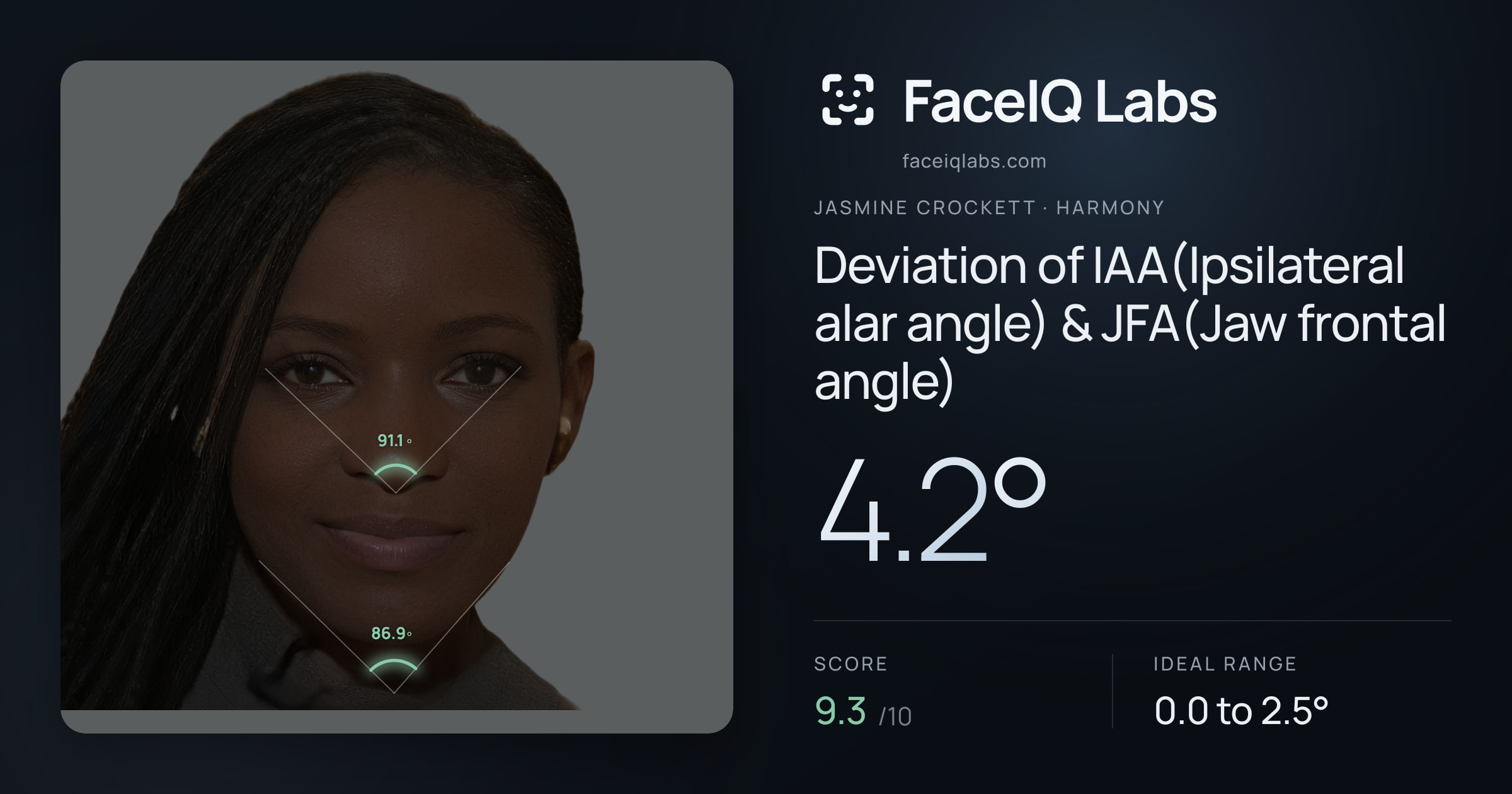Jasmine Crockett Deviation of IAA(Ipsilateral alar angle) & JFA(Jaw frontal angle): 4.2°, drawn on the photo