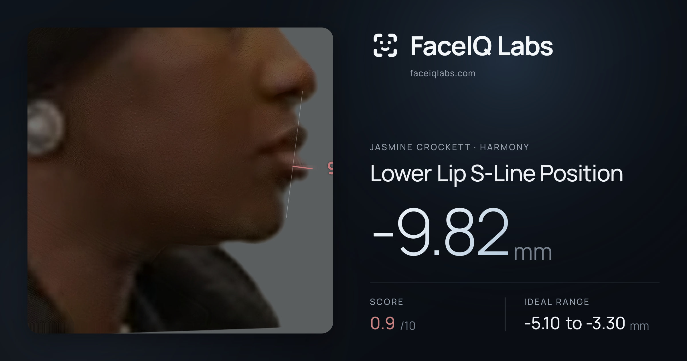 Jasmine Crockett Lower Lip S-Line Position: -9.82mm, drawn on the photo