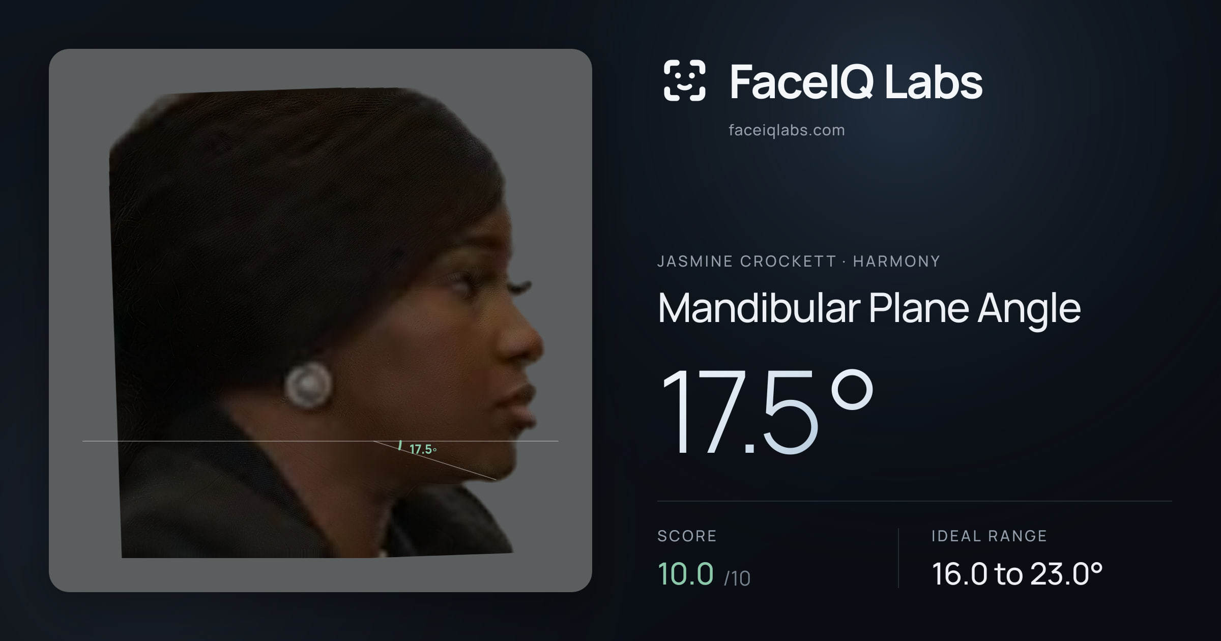 Jasmine Crockett Mandibular Plane Angle: 17.5°, drawn on the photo