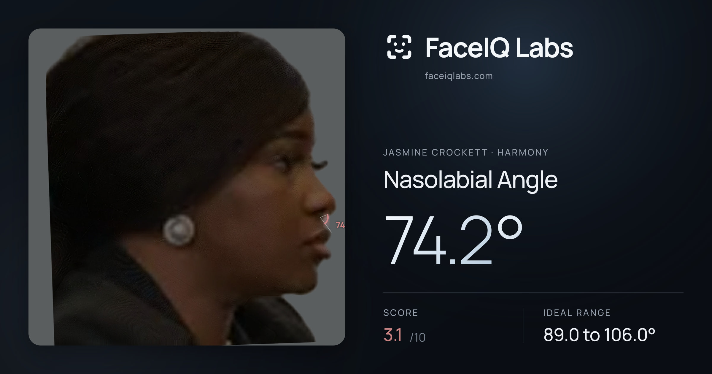 Jasmine Crockett Nasolabial Angle: 74.2°, drawn on the photo