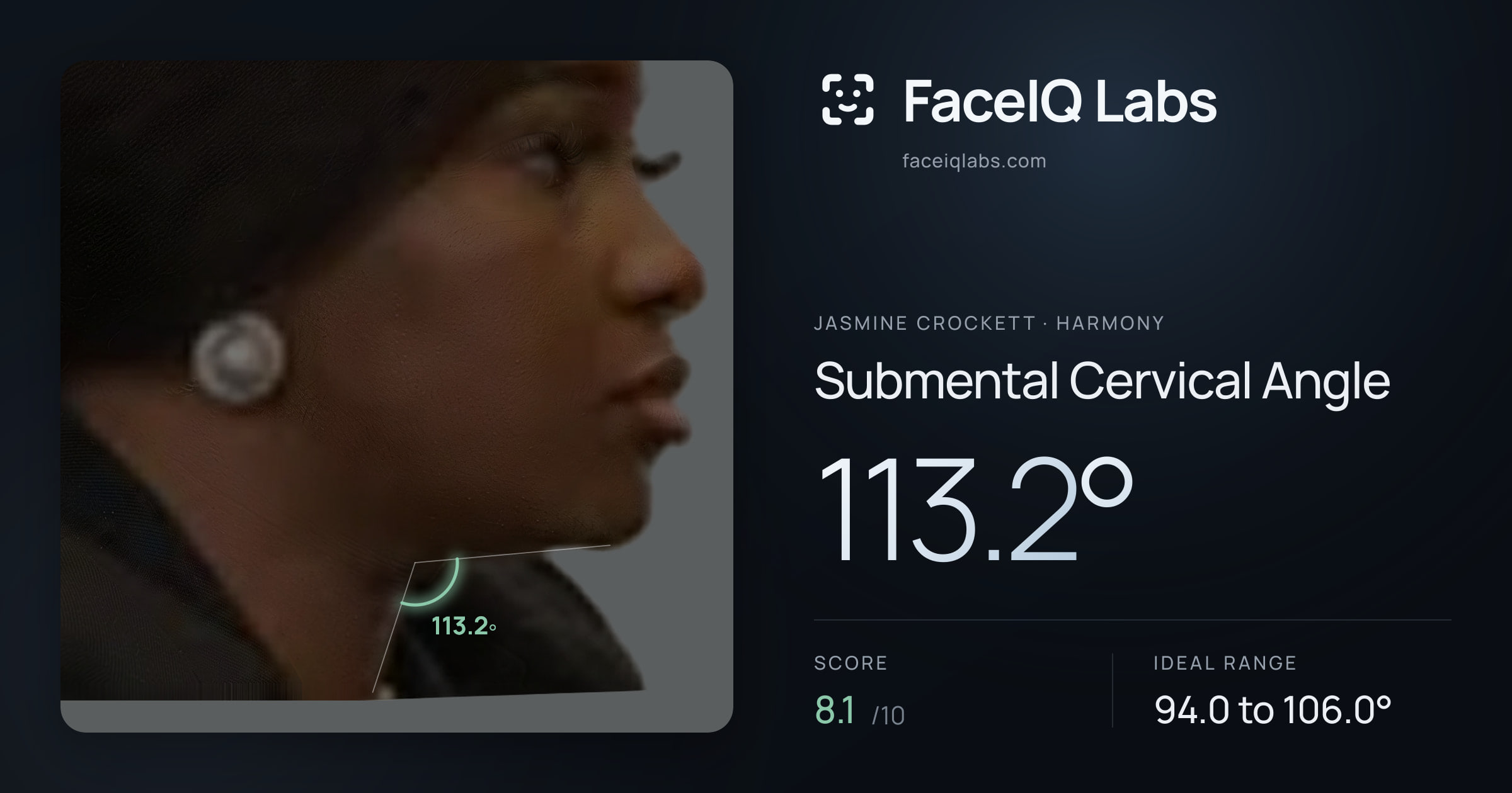 Jasmine Crockett Submental Cervical Angle: 113.2°, drawn on the photo