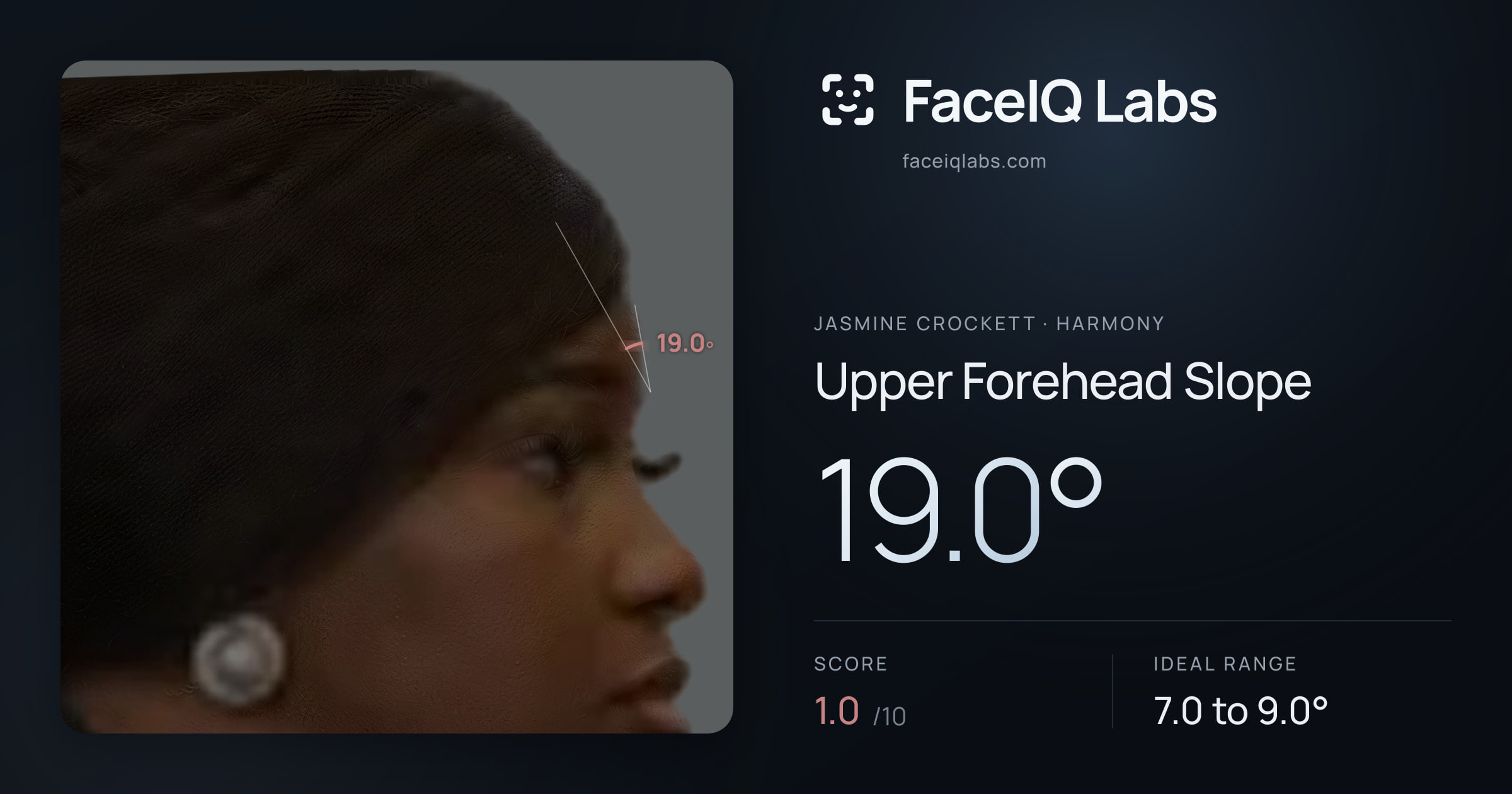 Jasmine Crockett Upper Forehead Slope: 19.0°, drawn on the photo