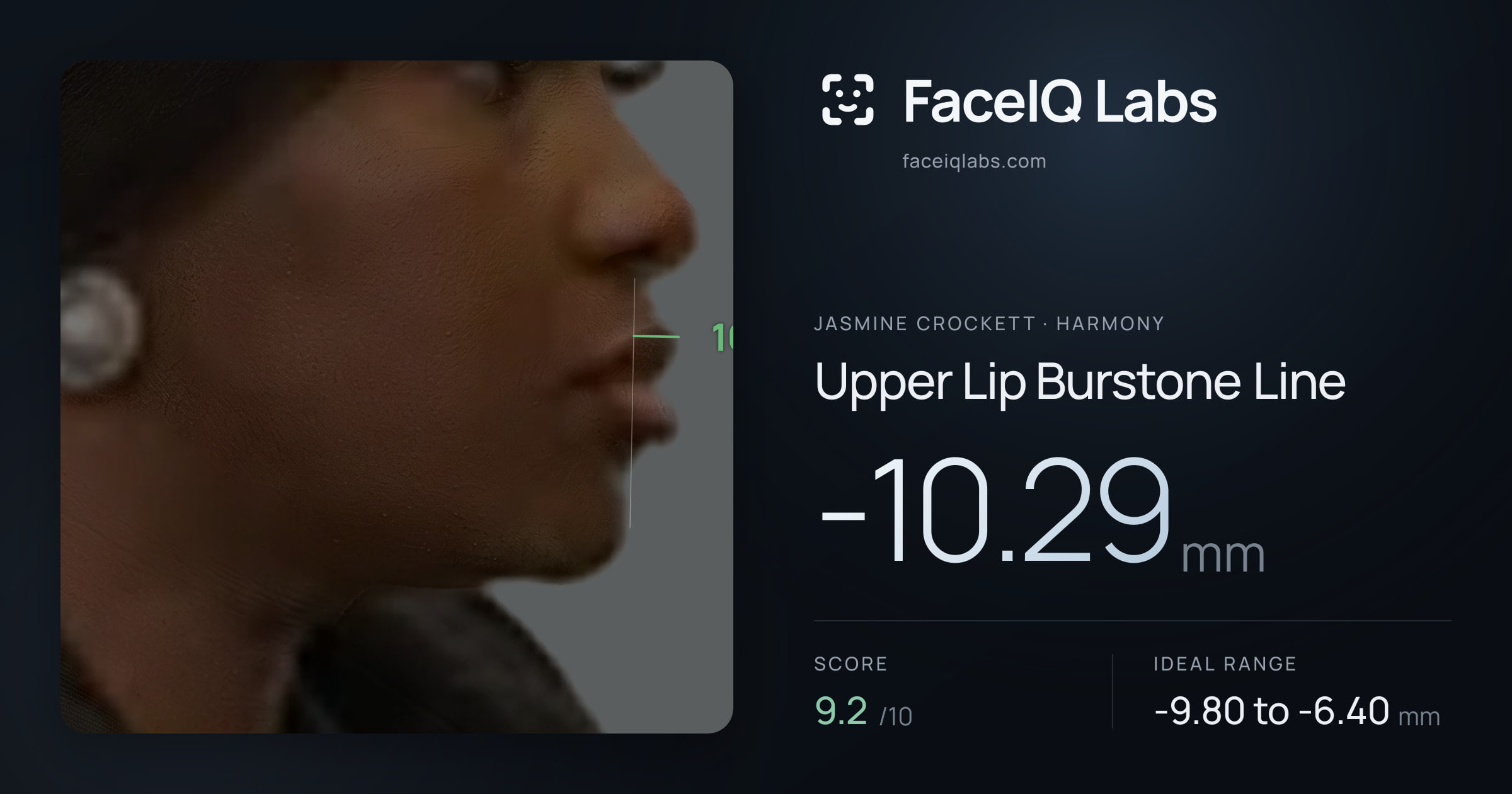 Jasmine Crockett Upper Lip Burstone Line: -10.29mm, drawn on the photo