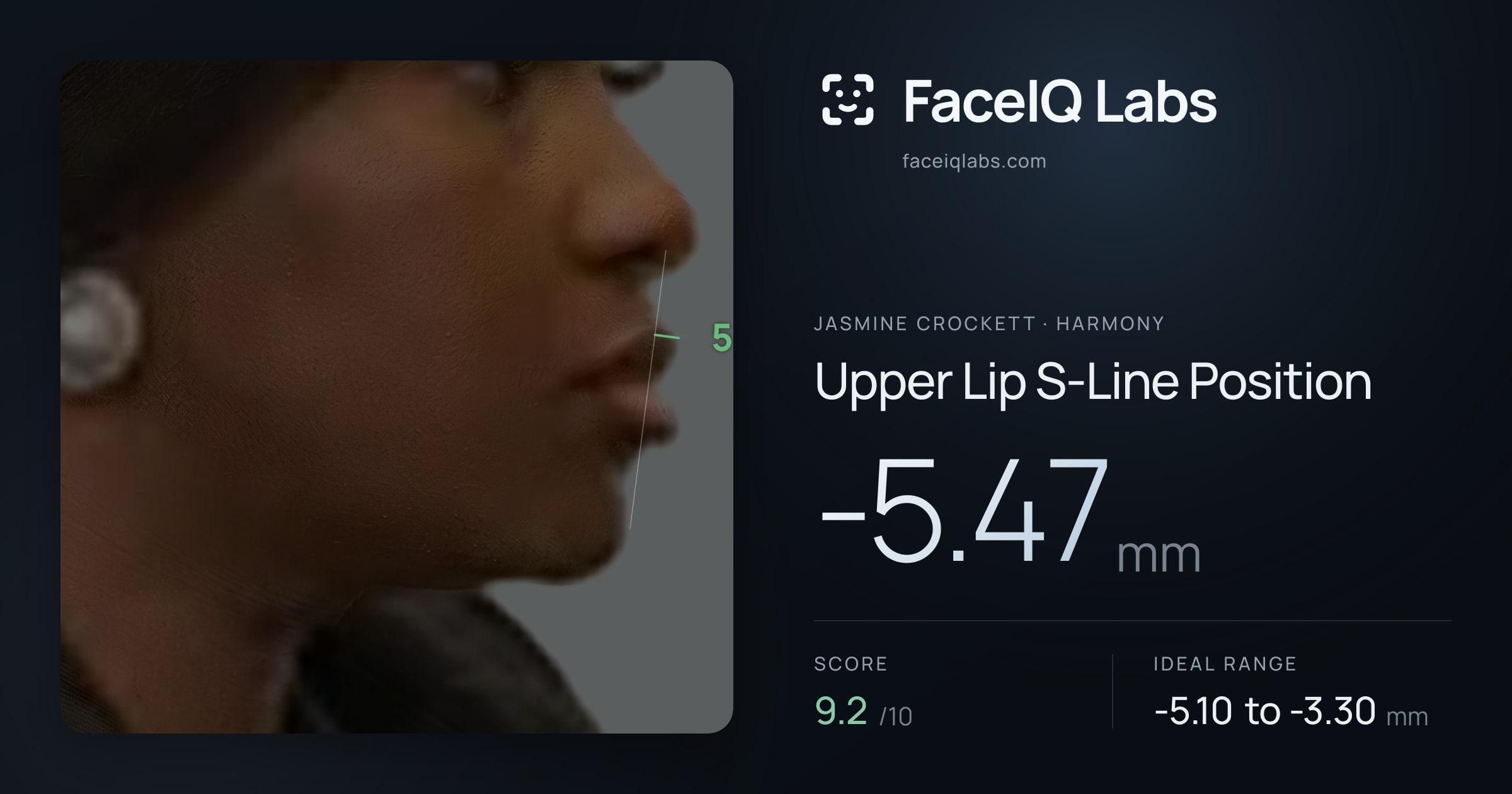 Jasmine Crockett Upper Lip S-Line Position: -5.47mm, drawn on the photo