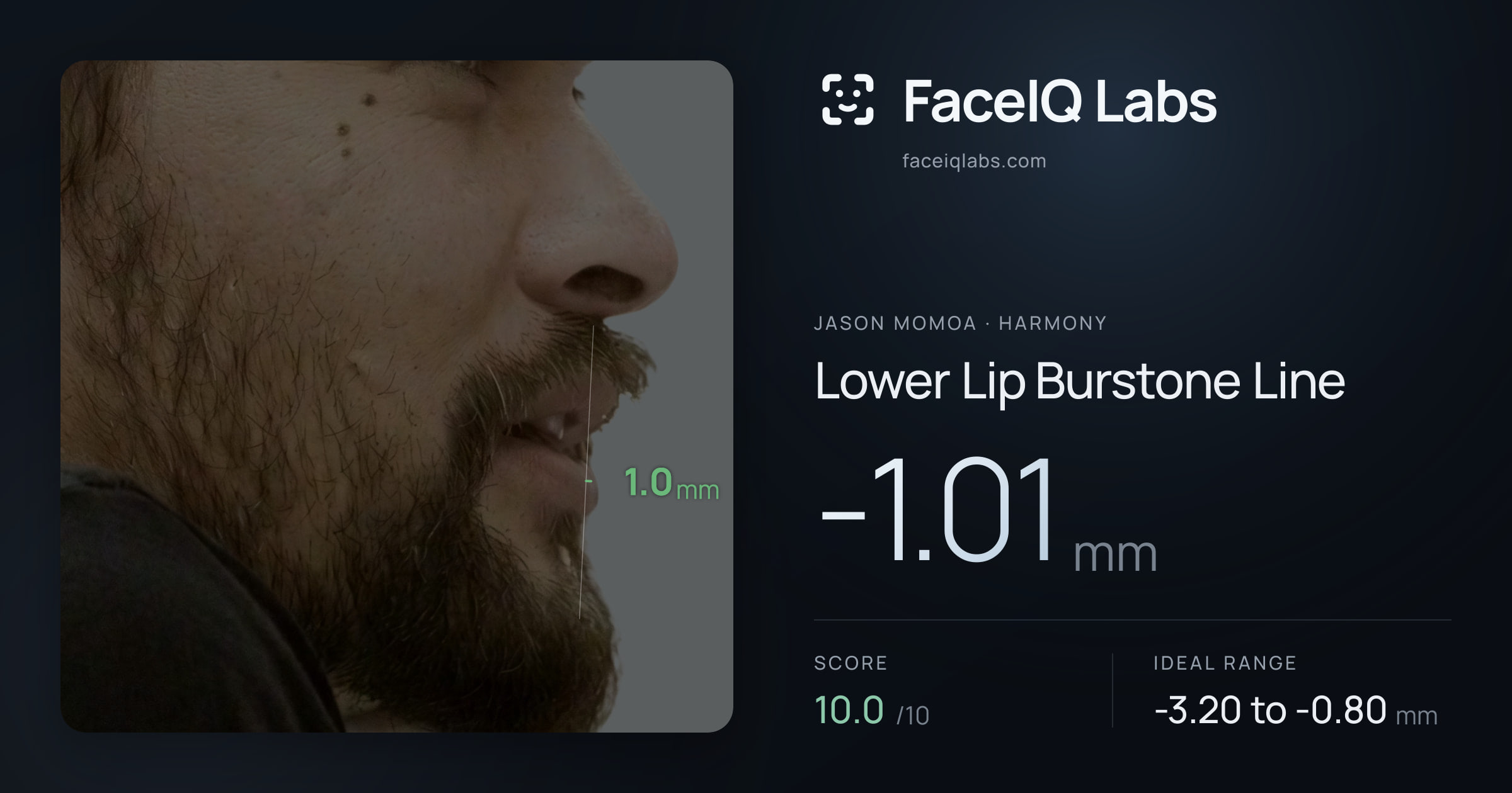 Jason Momoa Lower Lip Burstone Line: -1.01mm, drawn on the photo