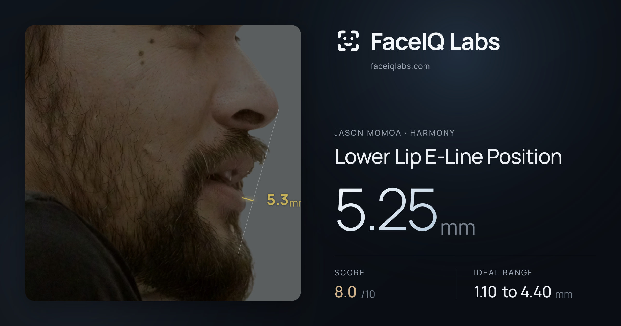 Jason Momoa Lower Lip E-Line Position: 5.25mm, drawn on the photo