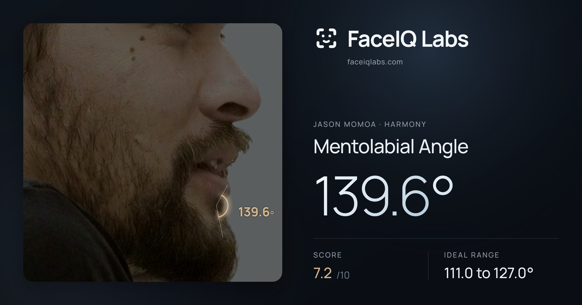 Jason Momoa Mentolabial Angle: 136.7°, drawn on the photo