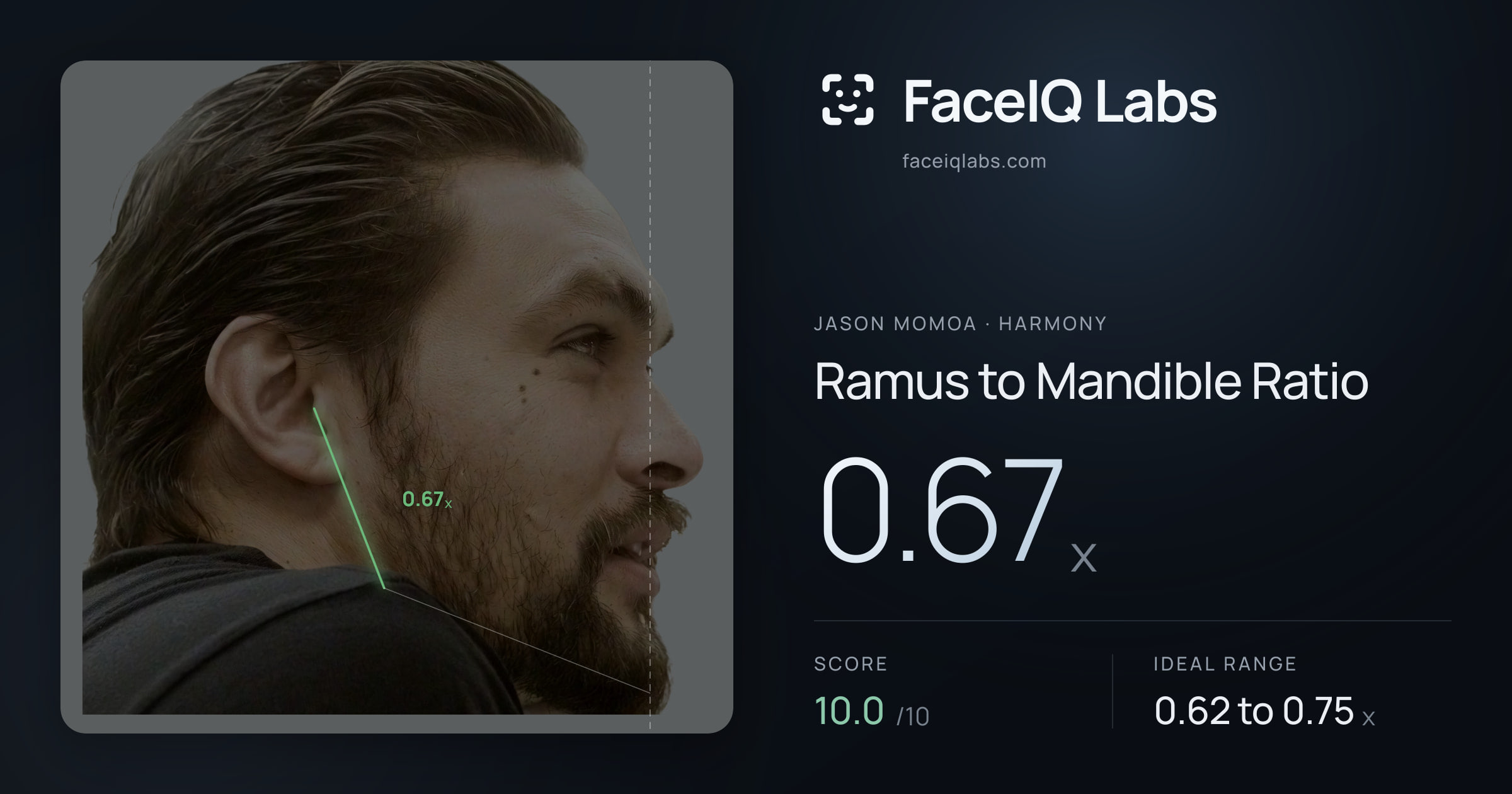 Jason Momoa Ramus to Mandible Ratio: 0.67x, drawn on the photo