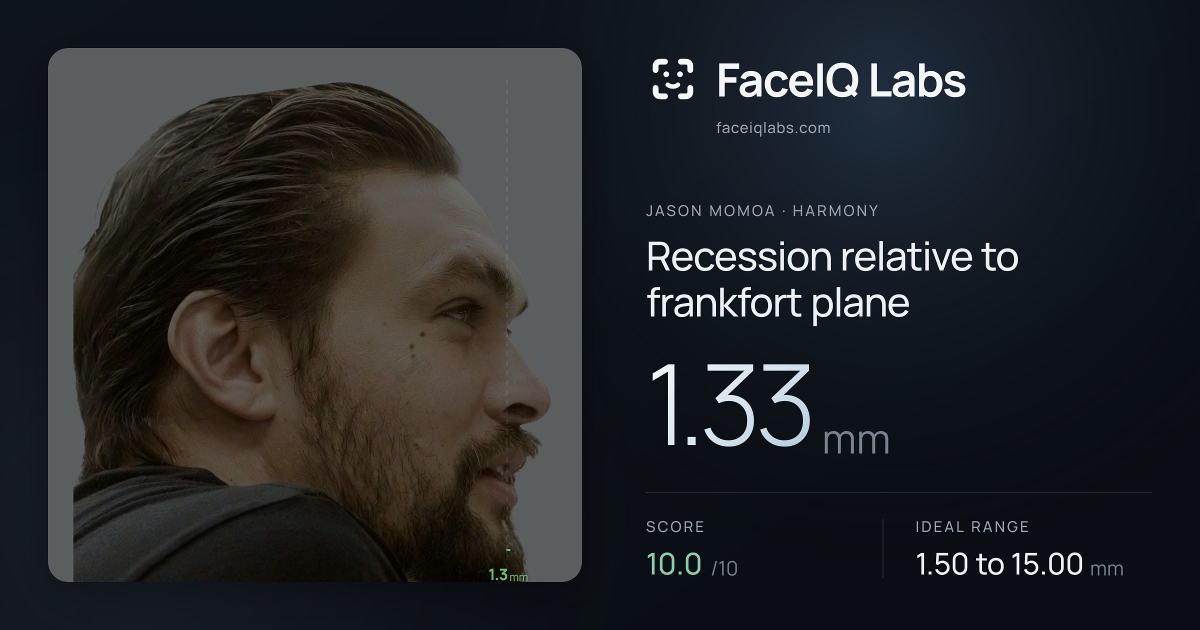 Jason Momoa Recession relative to frankfort plane: 4.09mm, drawn on the photo