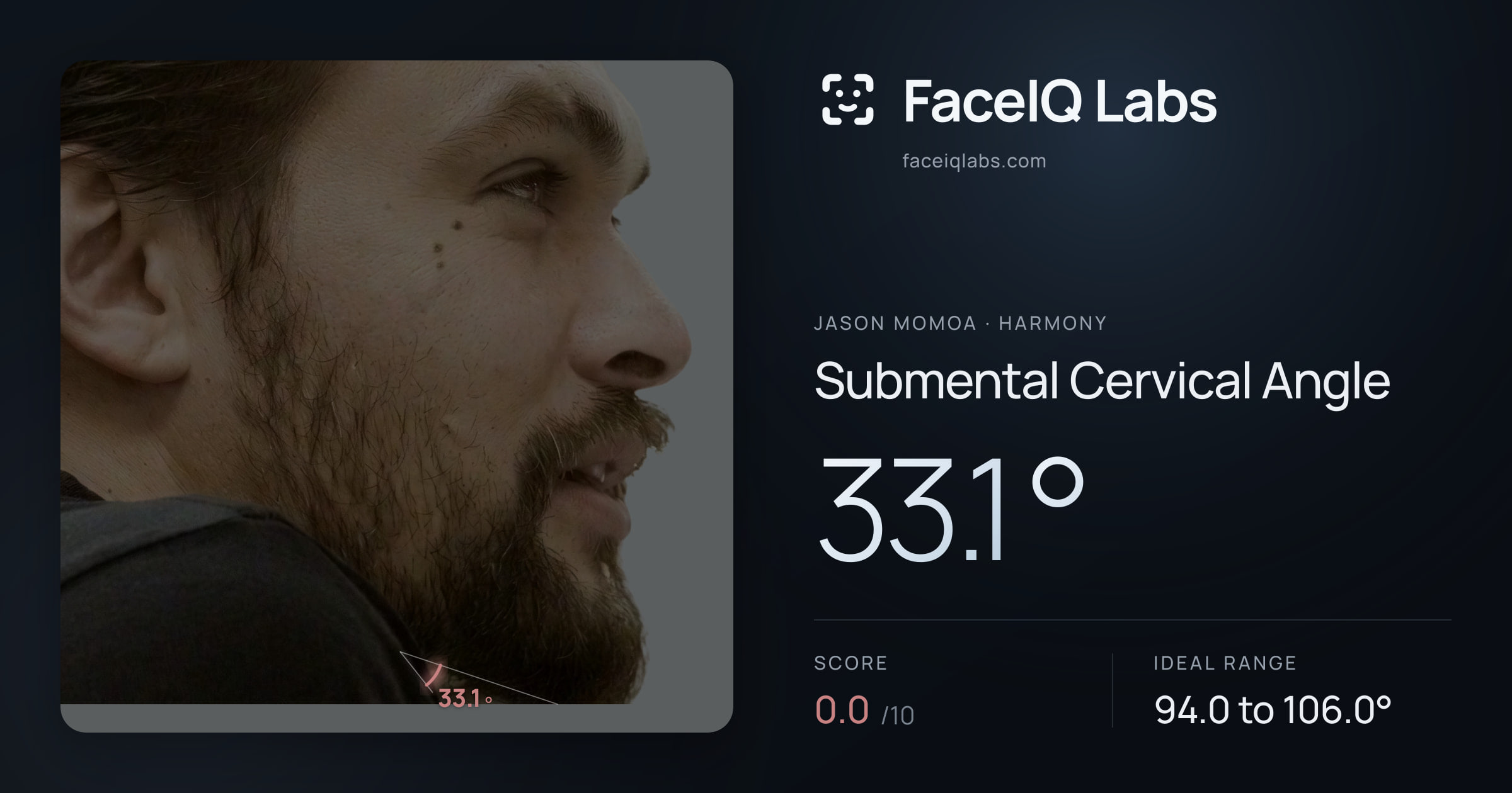 Jason Momoa Submental Cervical Angle: 33.1°, drawn on the photo