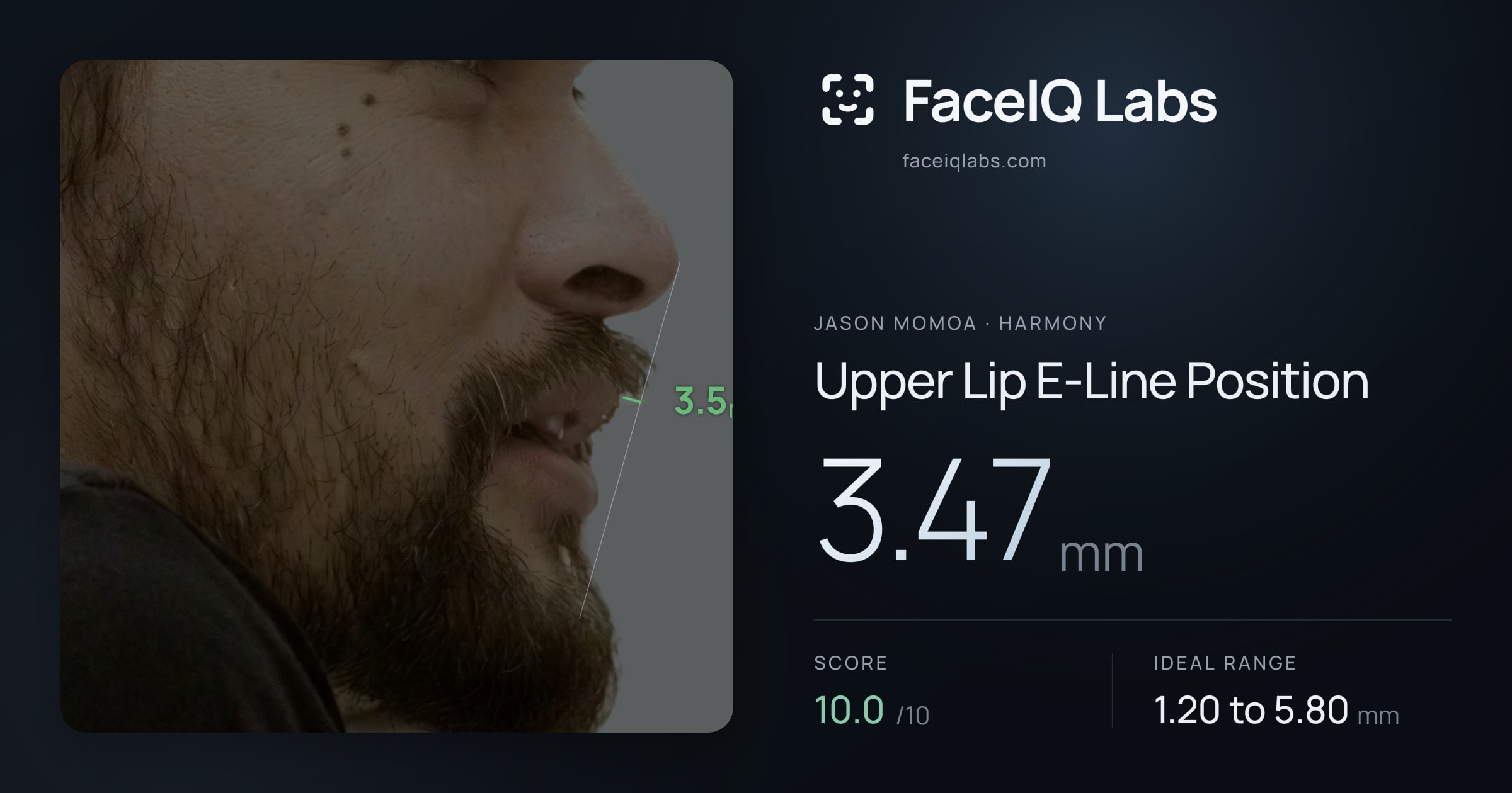 Jason Momoa Upper Lip E-Line Position: 4.94mm, drawn on the photo