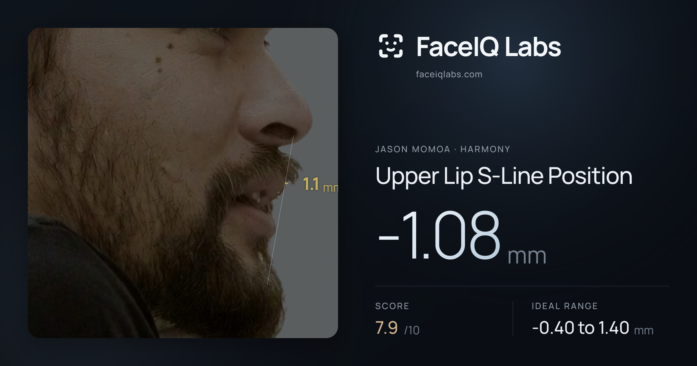 Jason Momoa Upper Lip S-Line Position: 0.17mm, drawn on the photo
