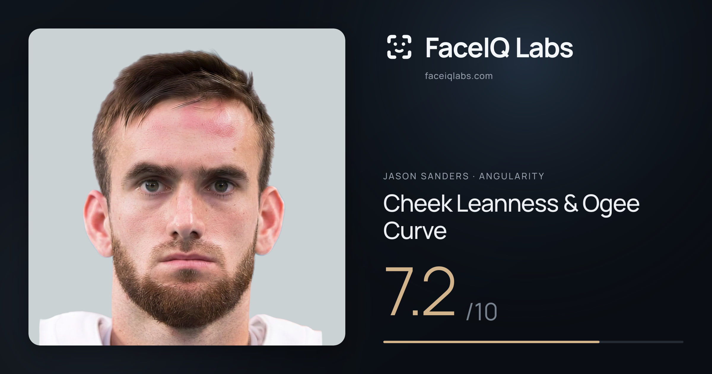 Jason Sanders Cheek Leanness & Ogee Curve: 7.2/10, drawn on the photo