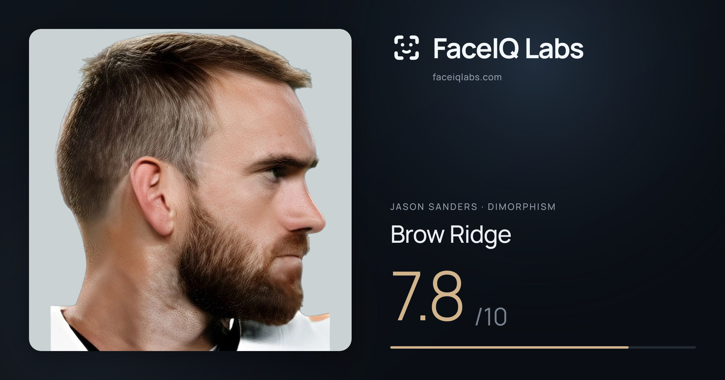 Jason Sanders Brow Ridge: 7.8/10, drawn on the photo