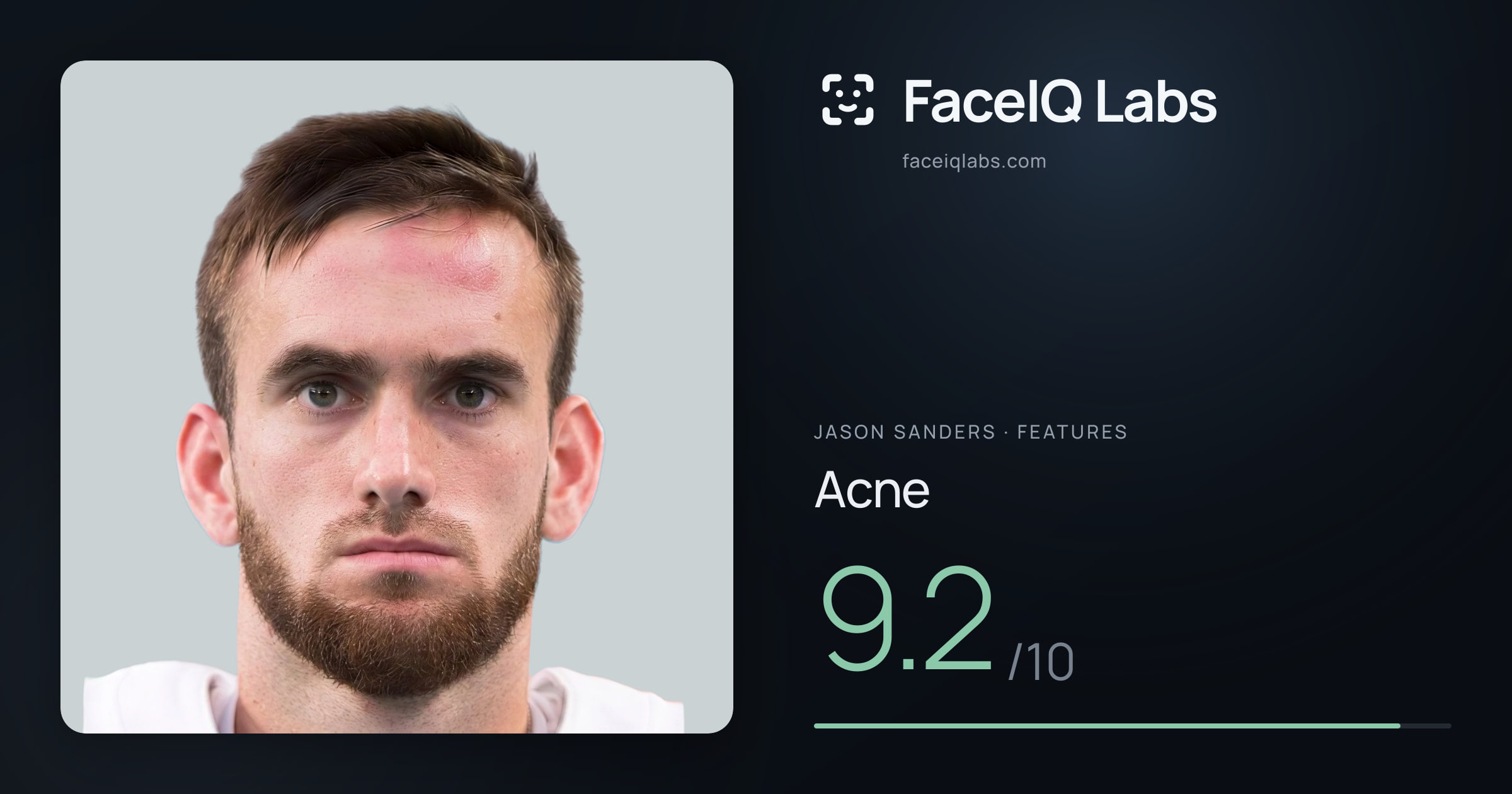 Jason Sanders Acne: 9.2/10, drawn on the photo