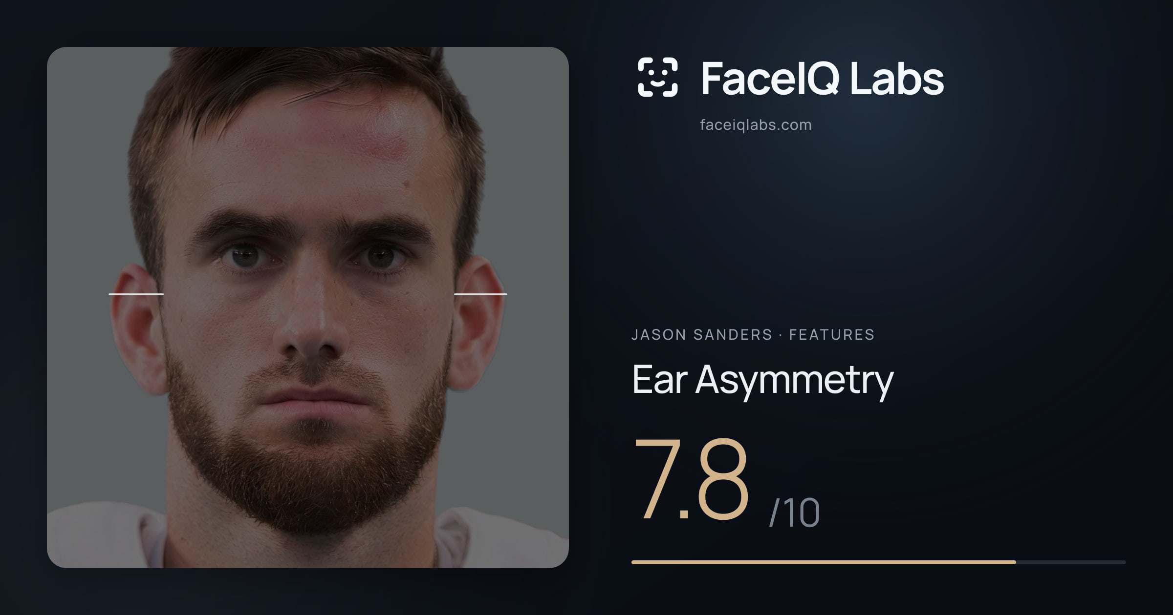 Jason Sanders Ear Asymmetry: 7.8/10, drawn on the photo