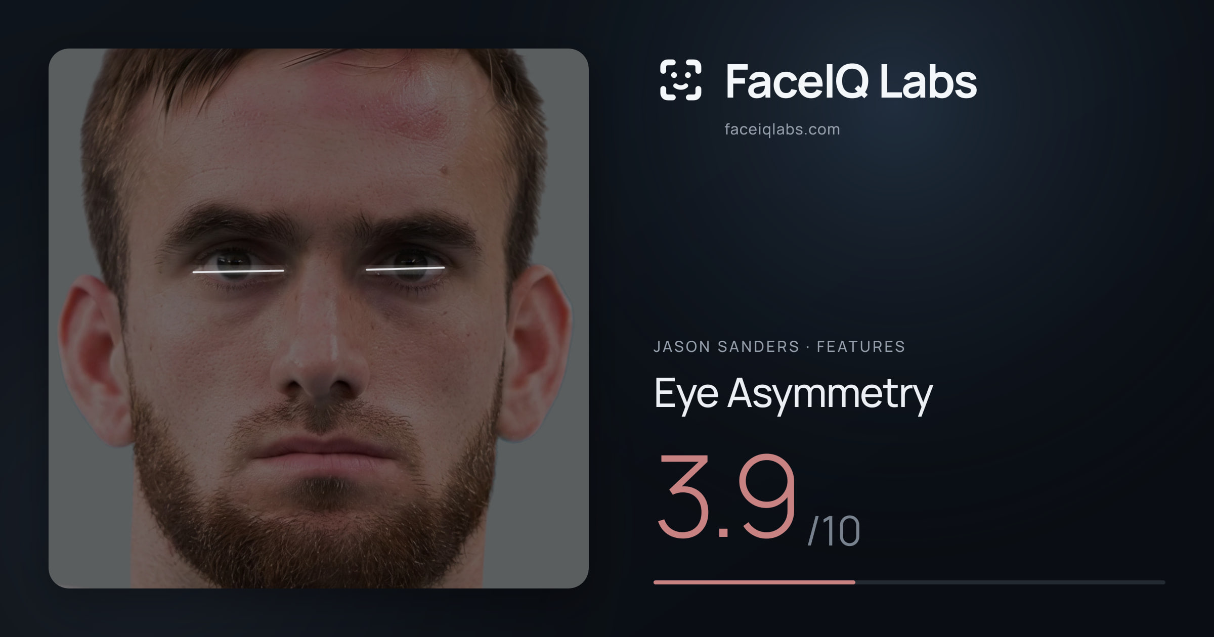 Jason Sanders Eye Asymmetry: 3.9/10, drawn on the photo
