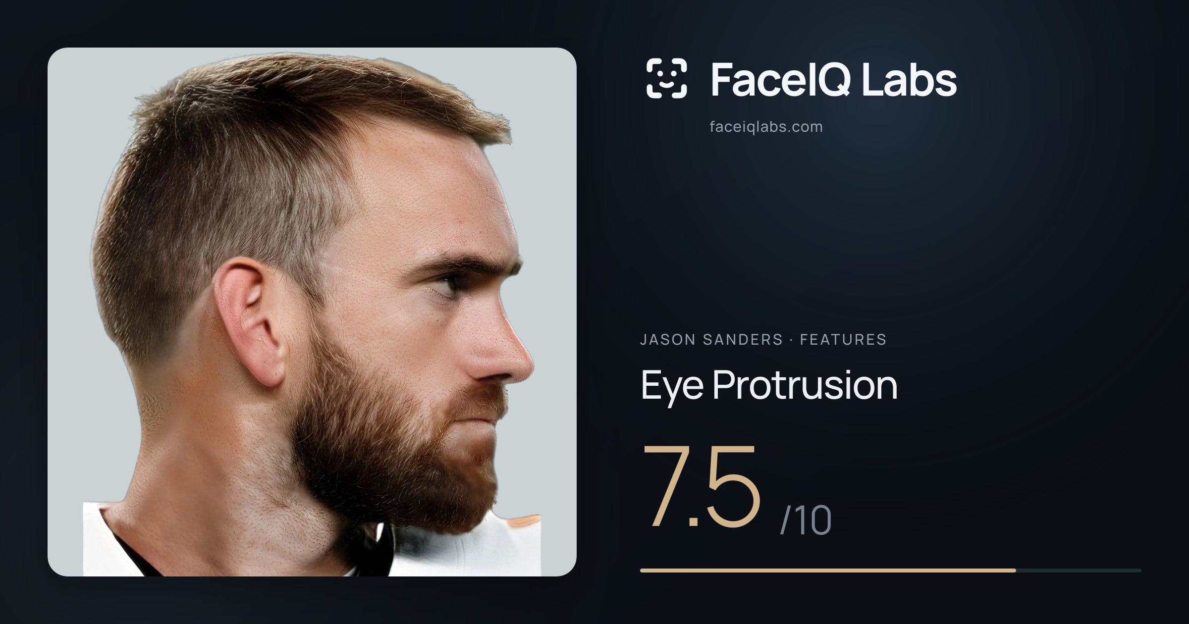 Jason Sanders Eye Protrusion: 7.5/10, drawn on the photo