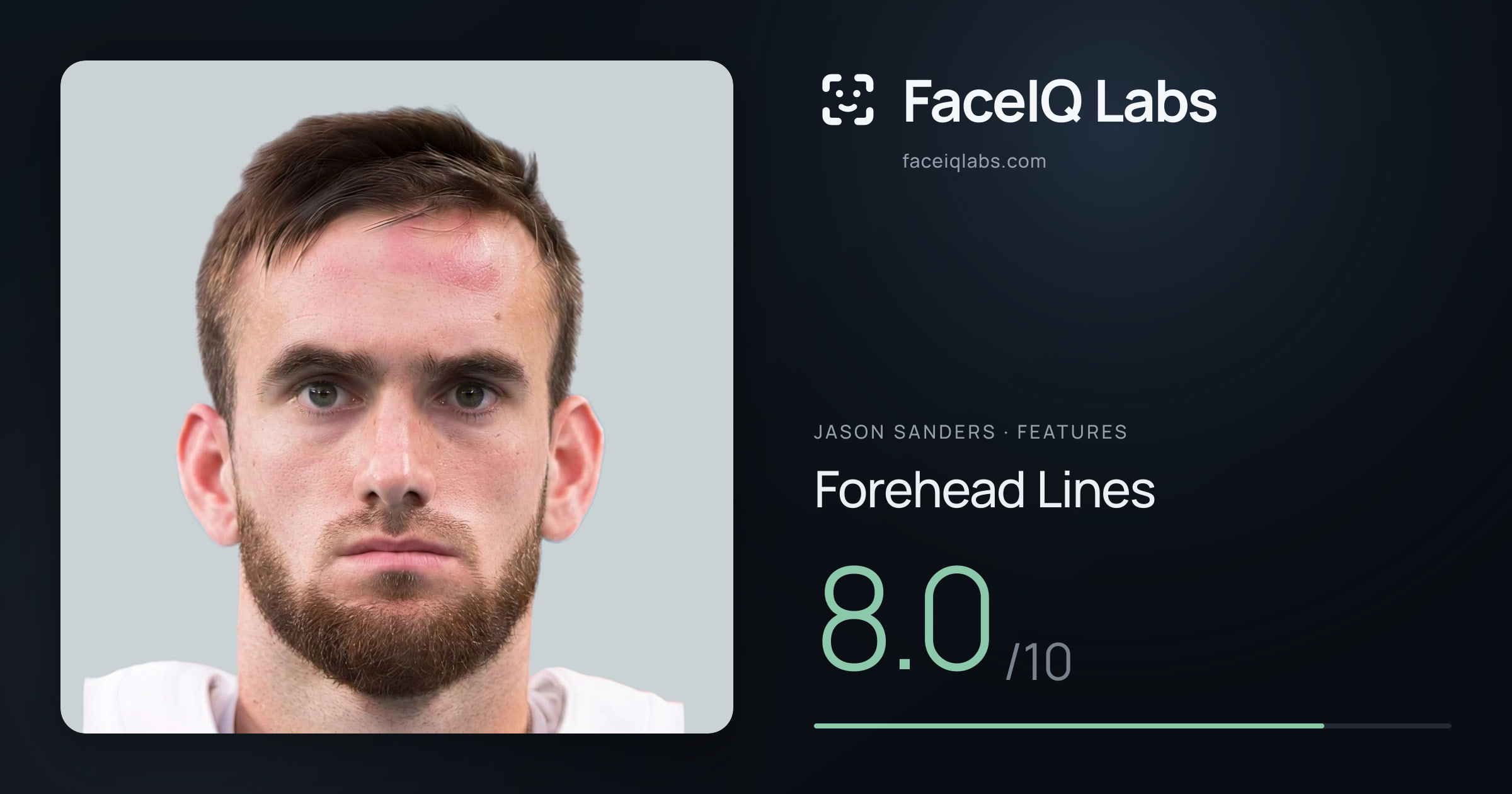 Jason Sanders Forehead Lines: 8.0/10, drawn on the photo