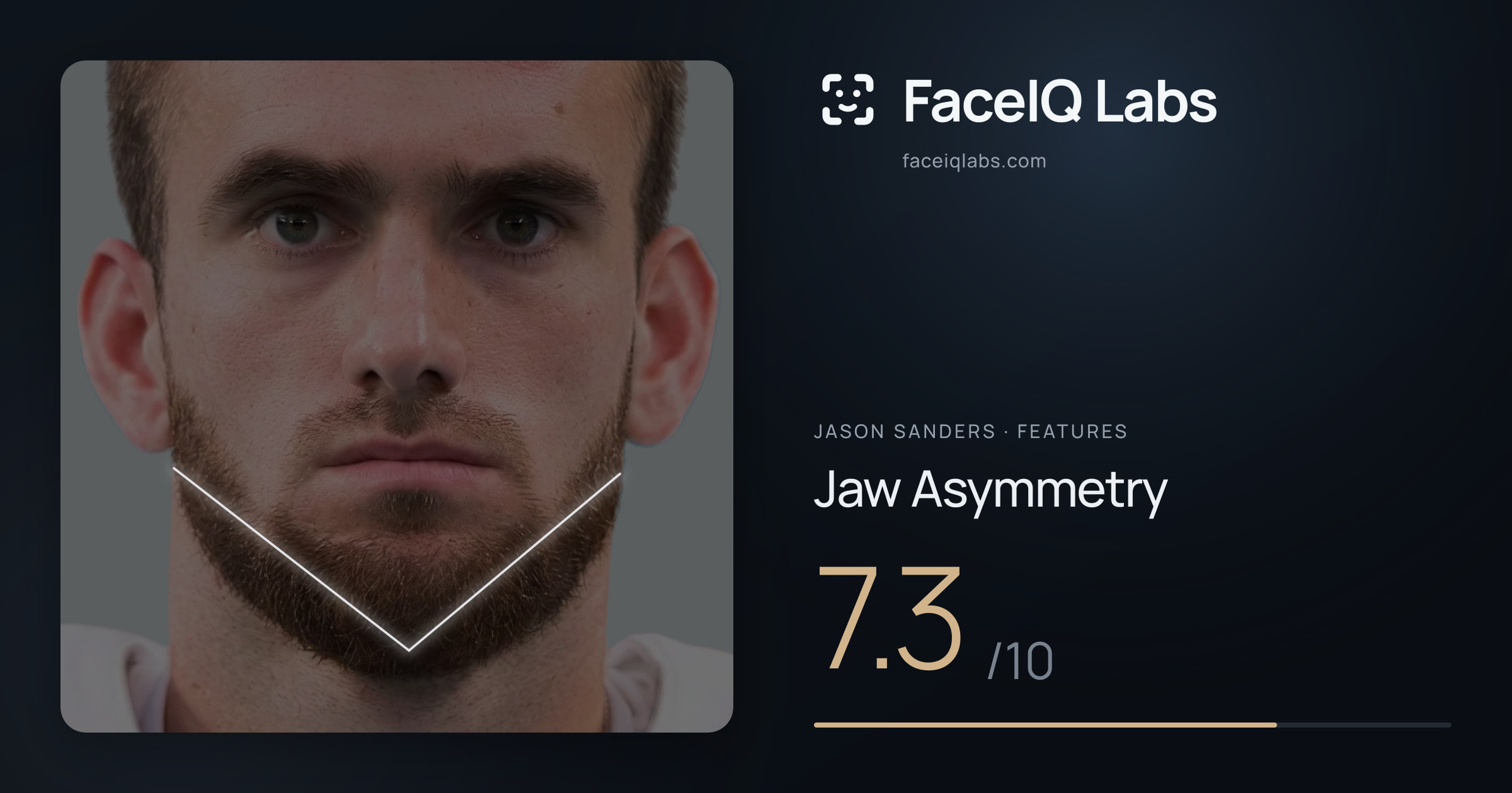 Jason Sanders Jaw Asymmetry: 7.3/10, drawn on the photo