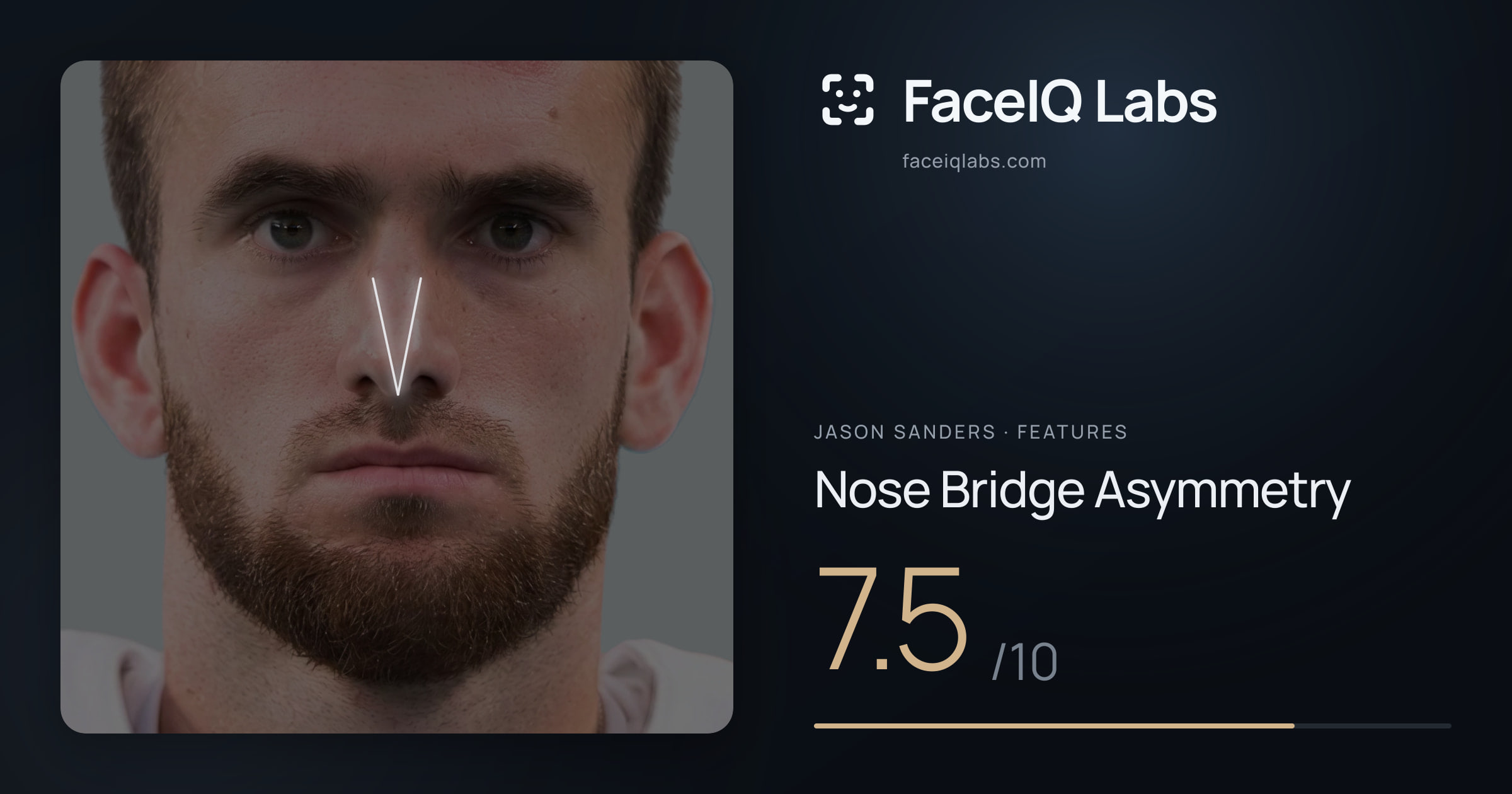 Jason Sanders Nose Bridge Asymmetry: 7.5/10, drawn on the photo