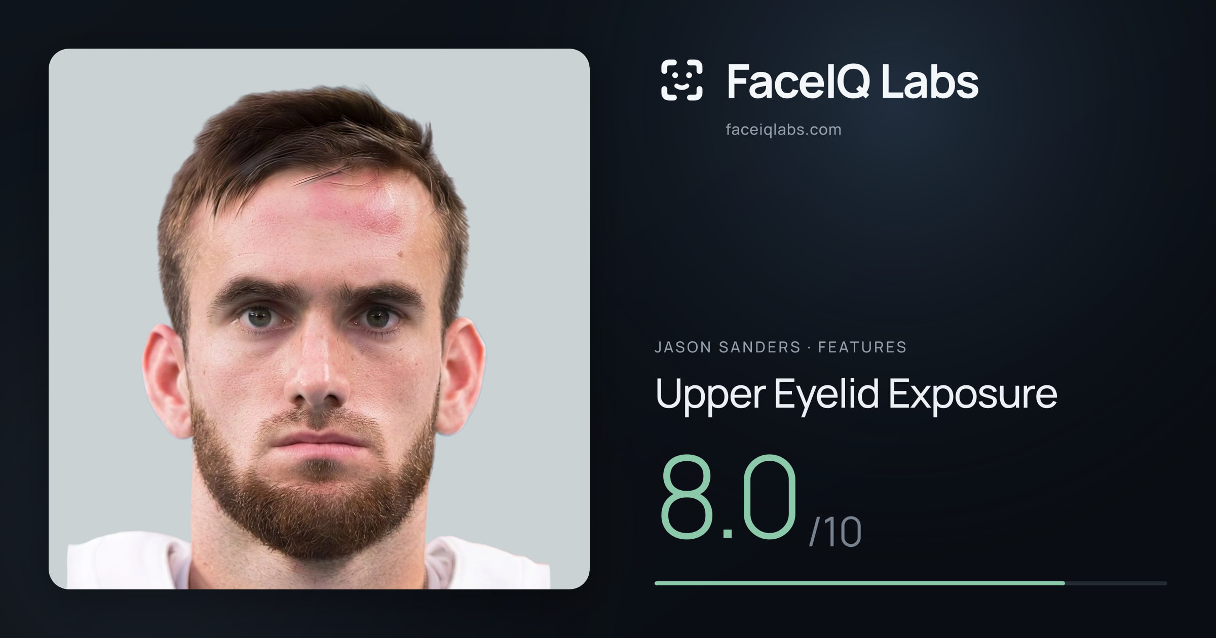 Jason Sanders Upper Eyelid Exposure: 8.0/10, drawn on the photo