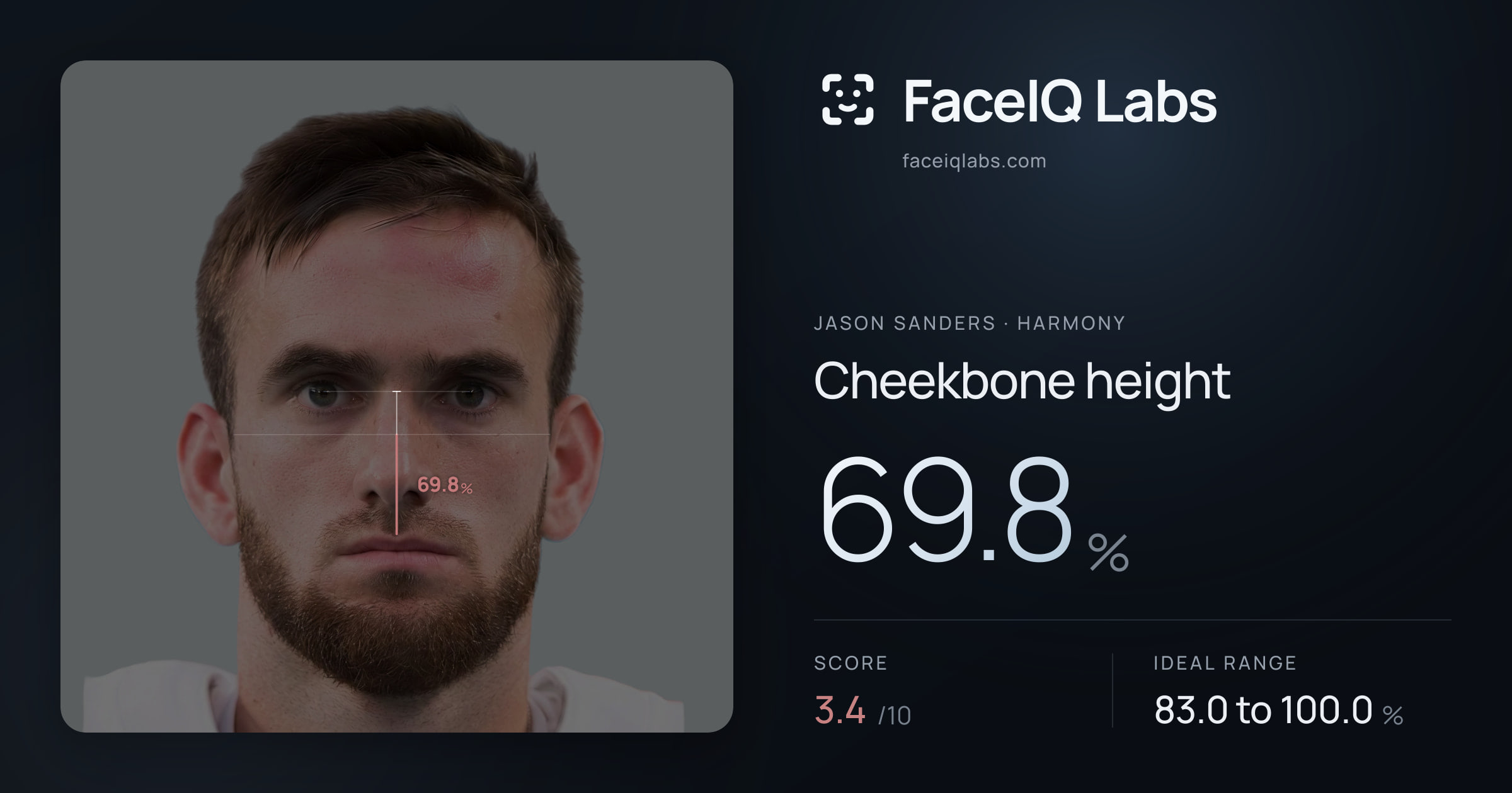 Jason Sanders Cheekbone height: 69.8%, drawn on the photo