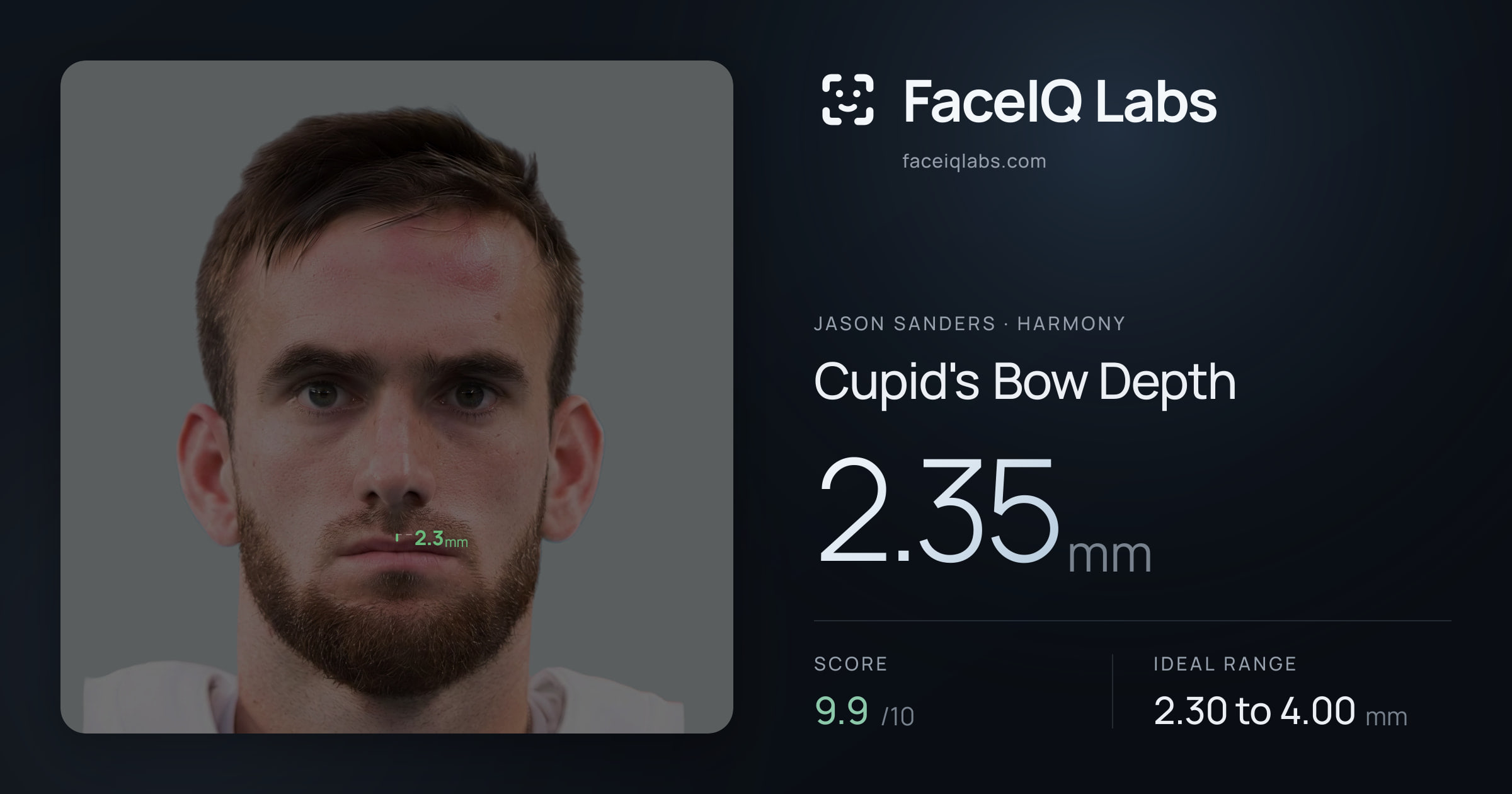 Jason Sanders Cupid's Bow Depth: 2.35mm, drawn on the photo