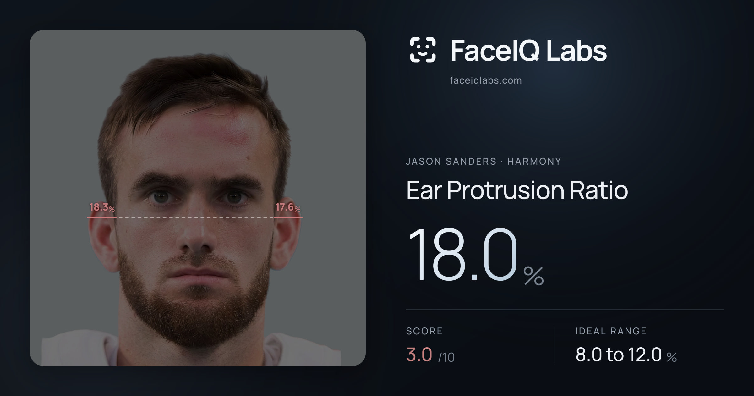 Jason Sanders Ear Protrusion Ratio: 18.0%, drawn on the photo