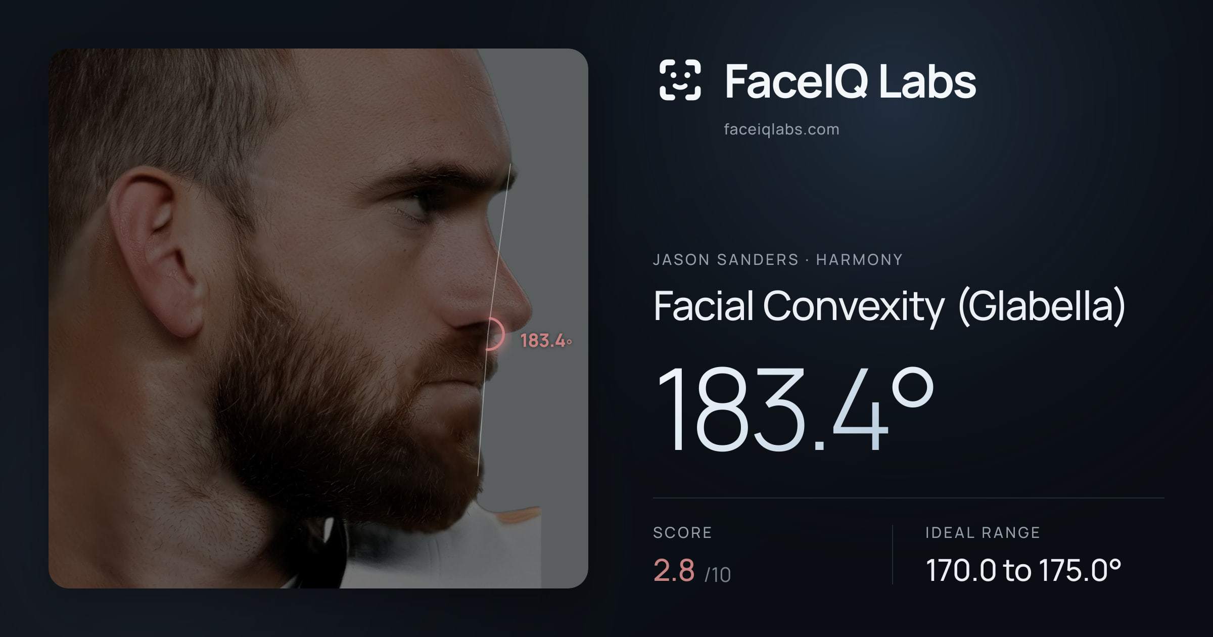 Jason Sanders Facial Convexity (Glabella): 183.4°, drawn on the photo