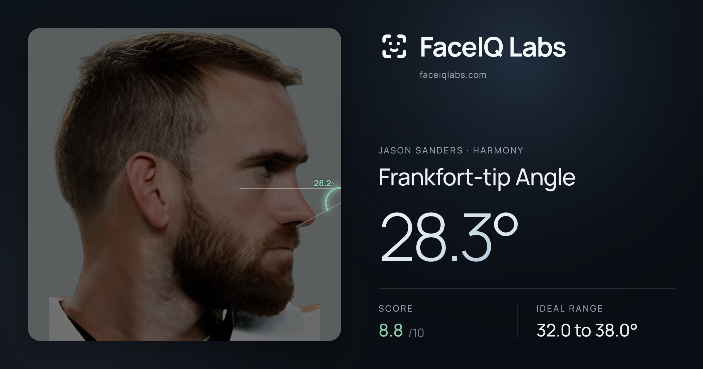 Jason Sanders Frankfort-tip Angle: 28.3°, drawn on the photo
