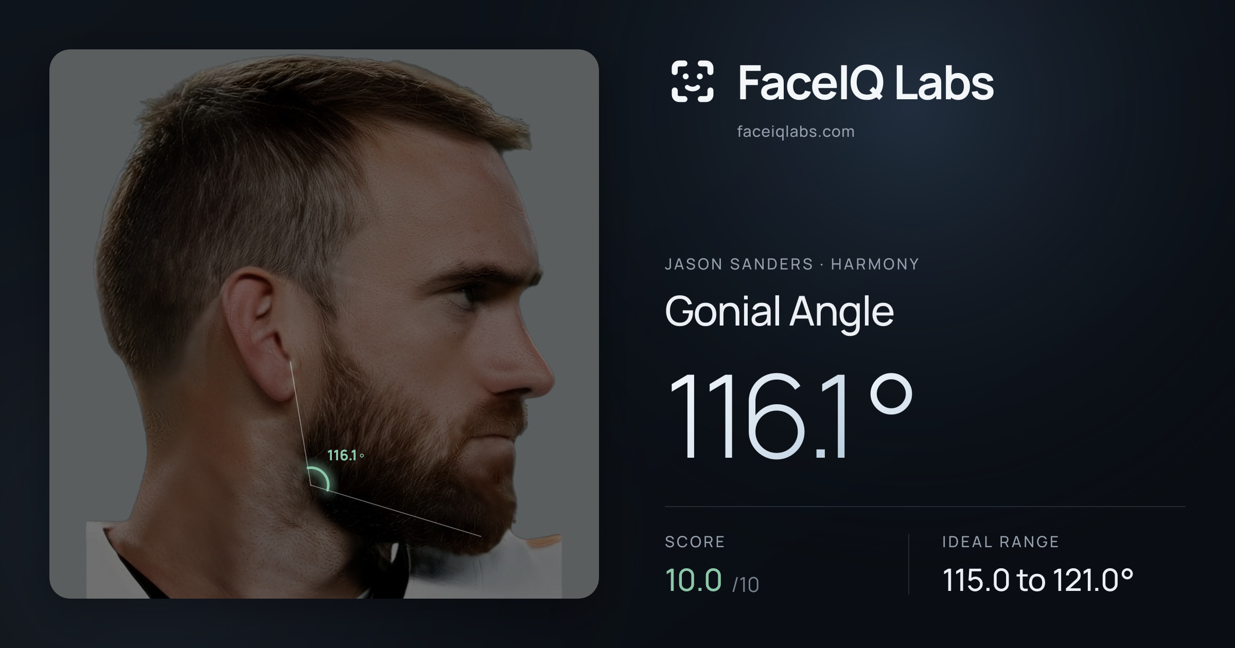 Jason Sanders Gonial Angle: 116.1°, drawn on the photo