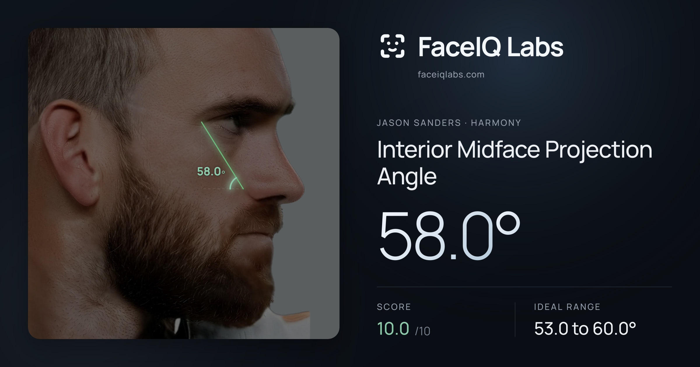 Jason Sanders Interior Midface Projection Angle: 58.0°, drawn on the photo