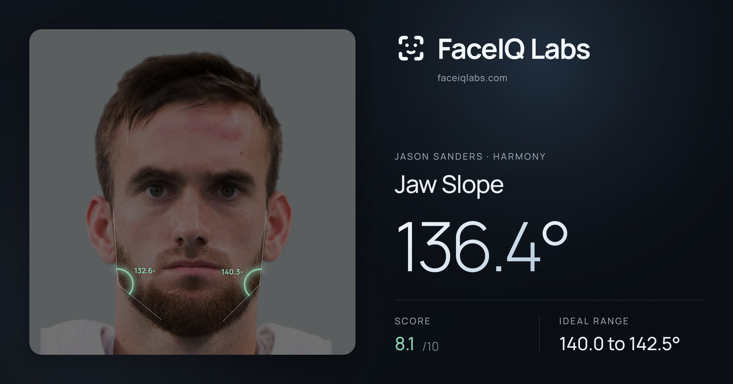 Jason Sanders Jaw Slope: 136.4°, drawn on the photo