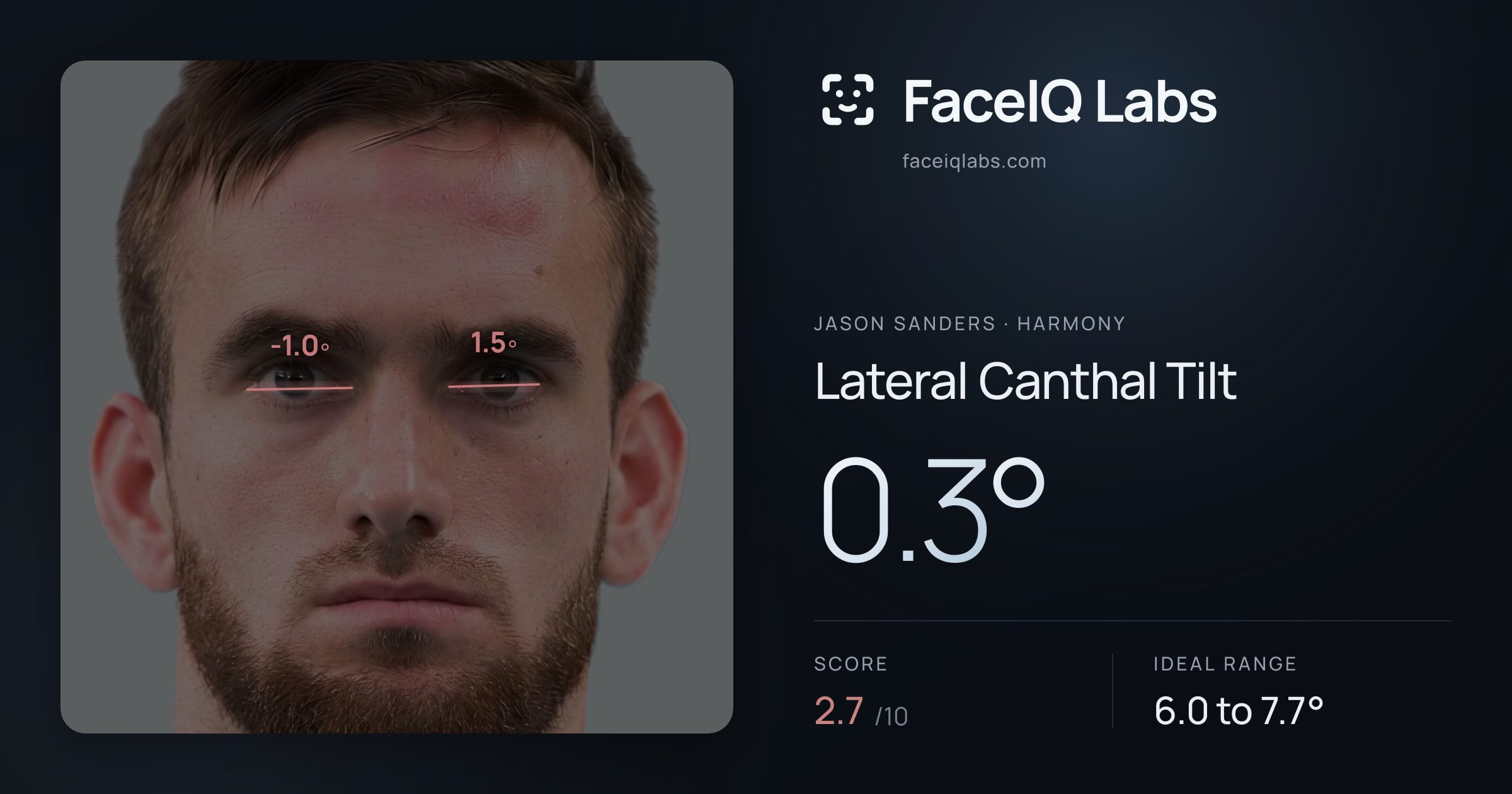 Jason Sanders Lateral Canthal Tilt: 0.3°, drawn on the photo