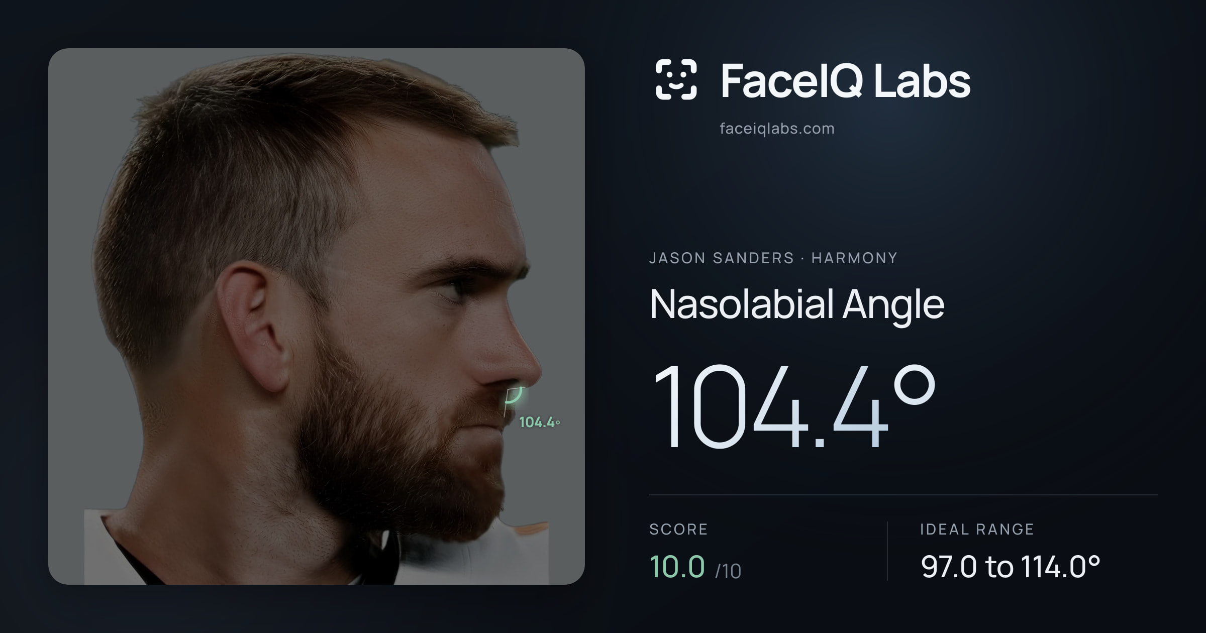 Jason Sanders Nasolabial Angle: 104.4°, drawn on the photo