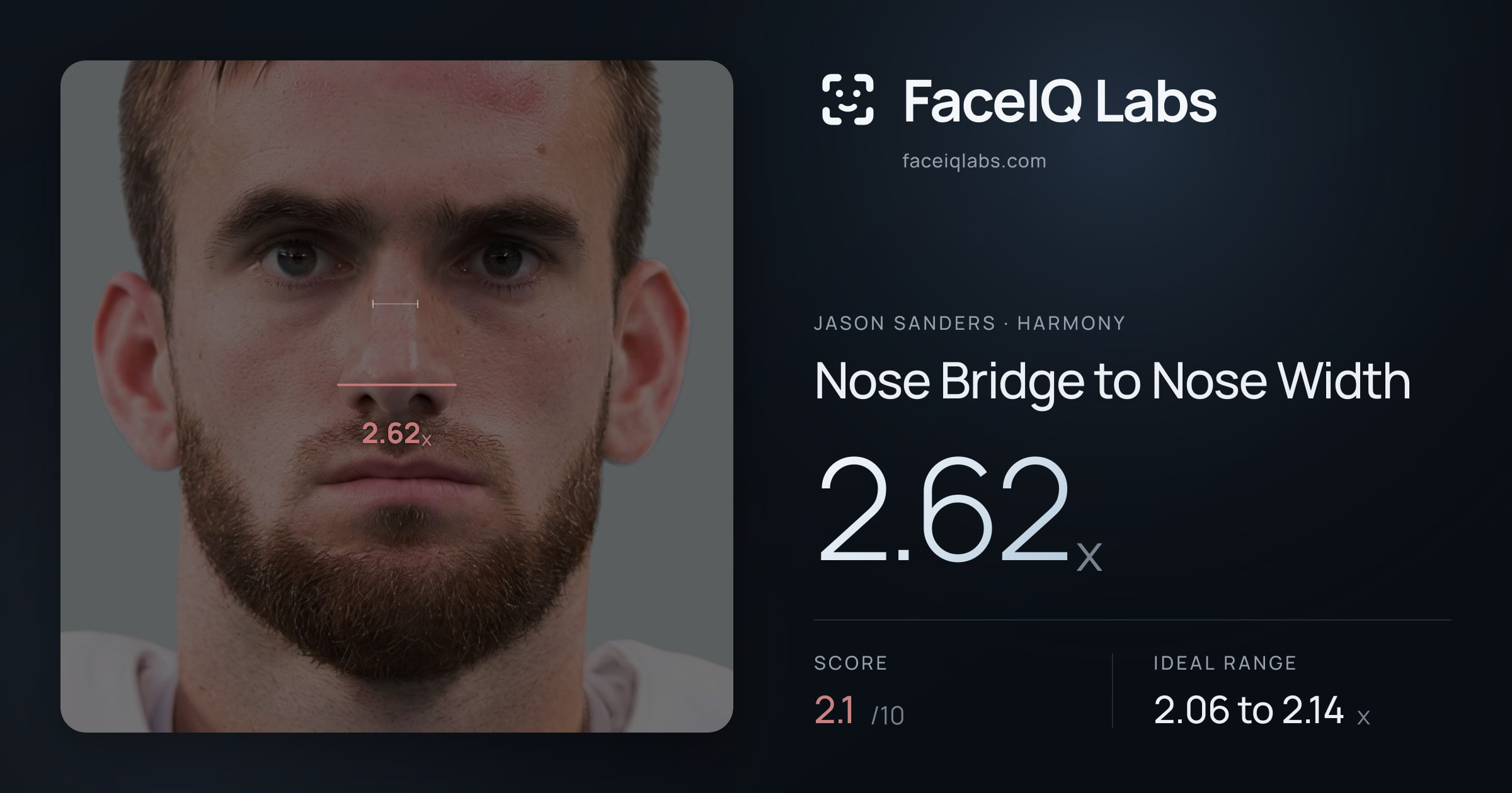 Jason Sanders Nose Bridge to Nose Width: 2.62x, drawn on the photo