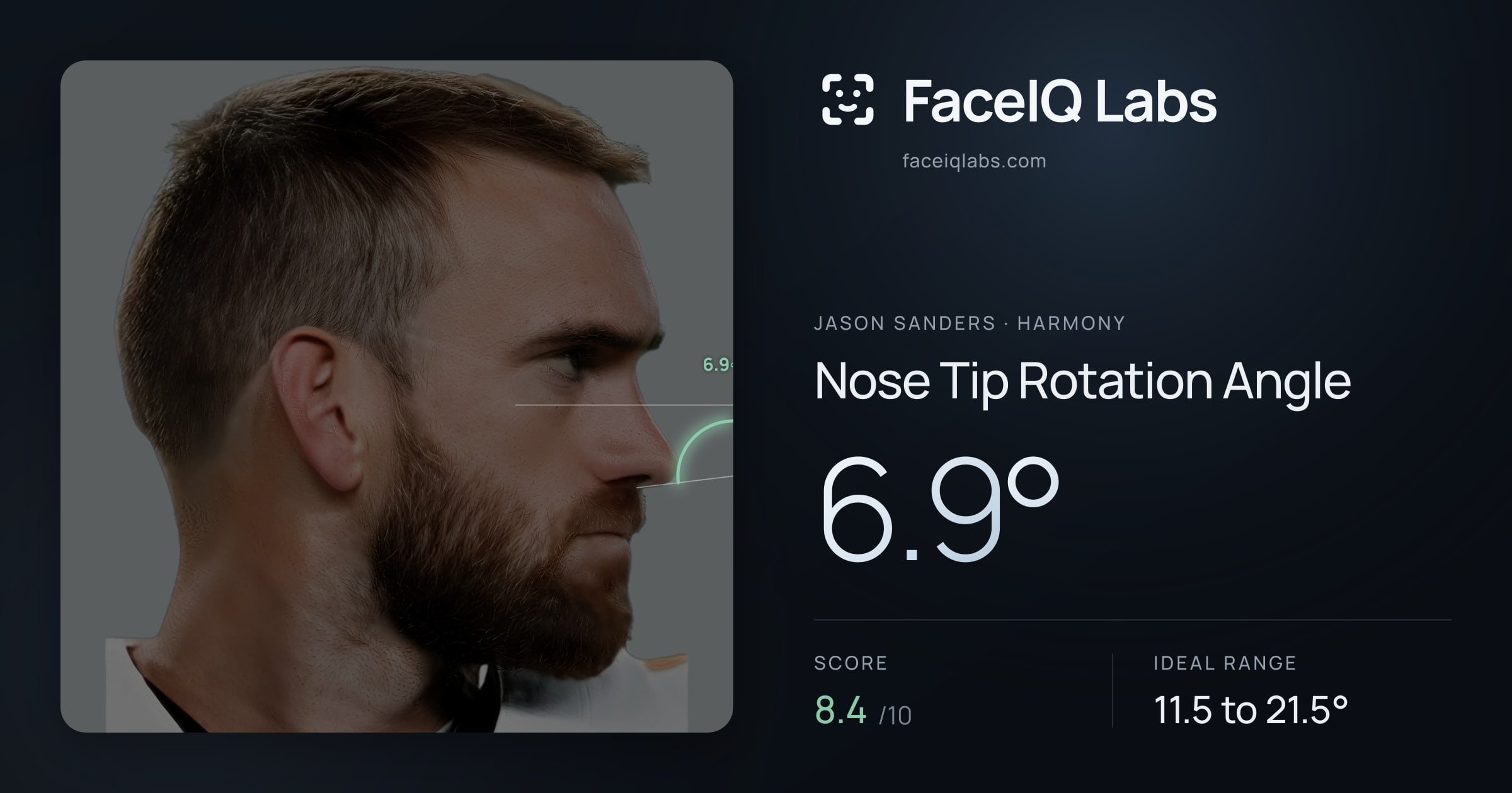 Jason Sanders Nose Tip Rotation Angle: 6.9°, drawn on the photo