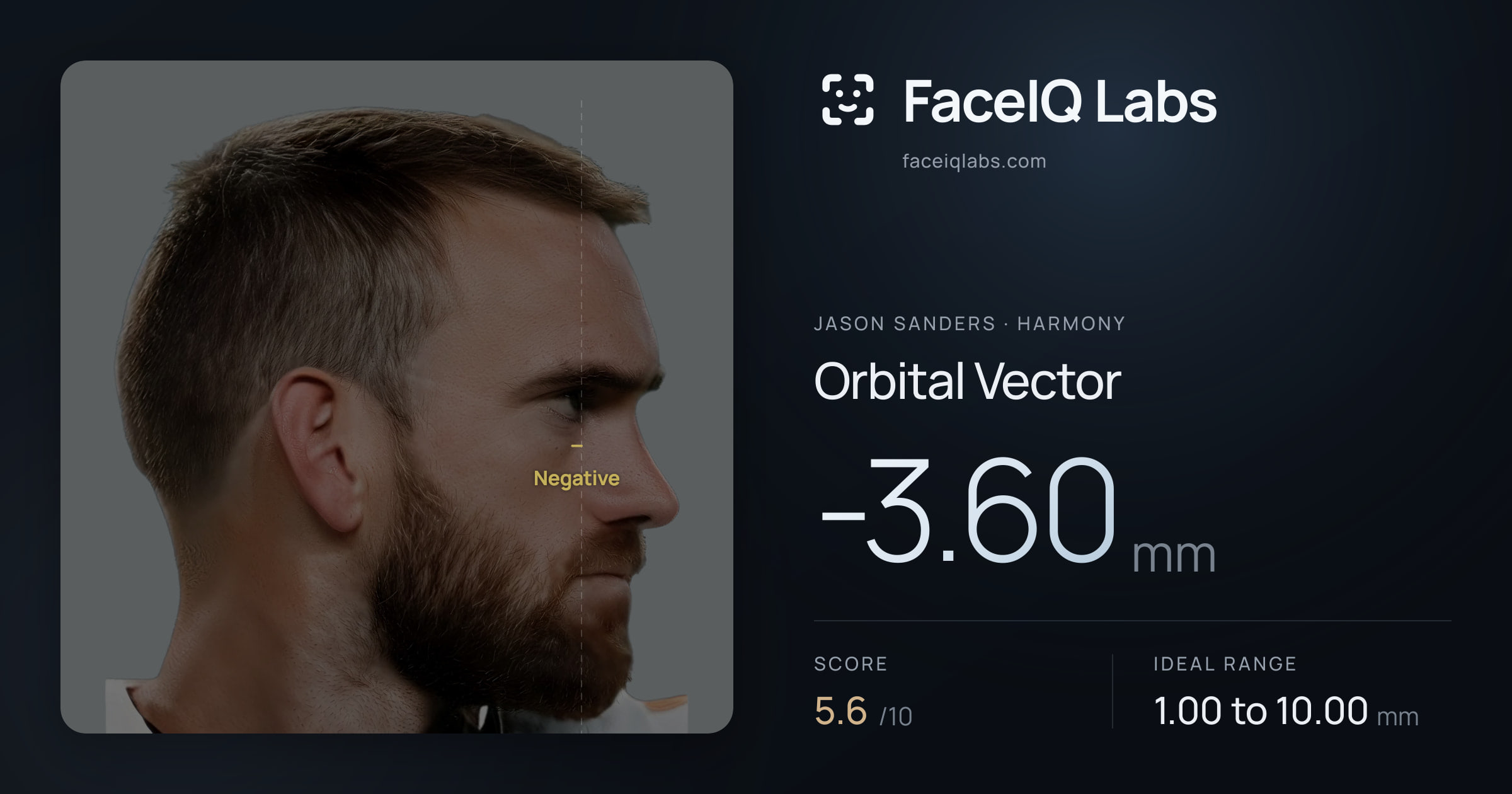 Jason Sanders Orbital Vector: -3.60mm, drawn on the photo