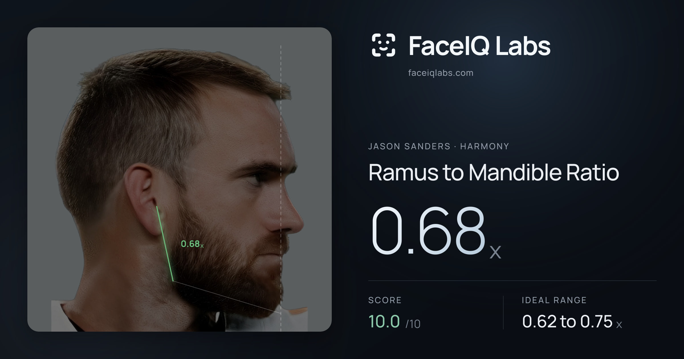 Jason Sanders Ramus to Mandible Ratio: 0.68x, drawn on the photo