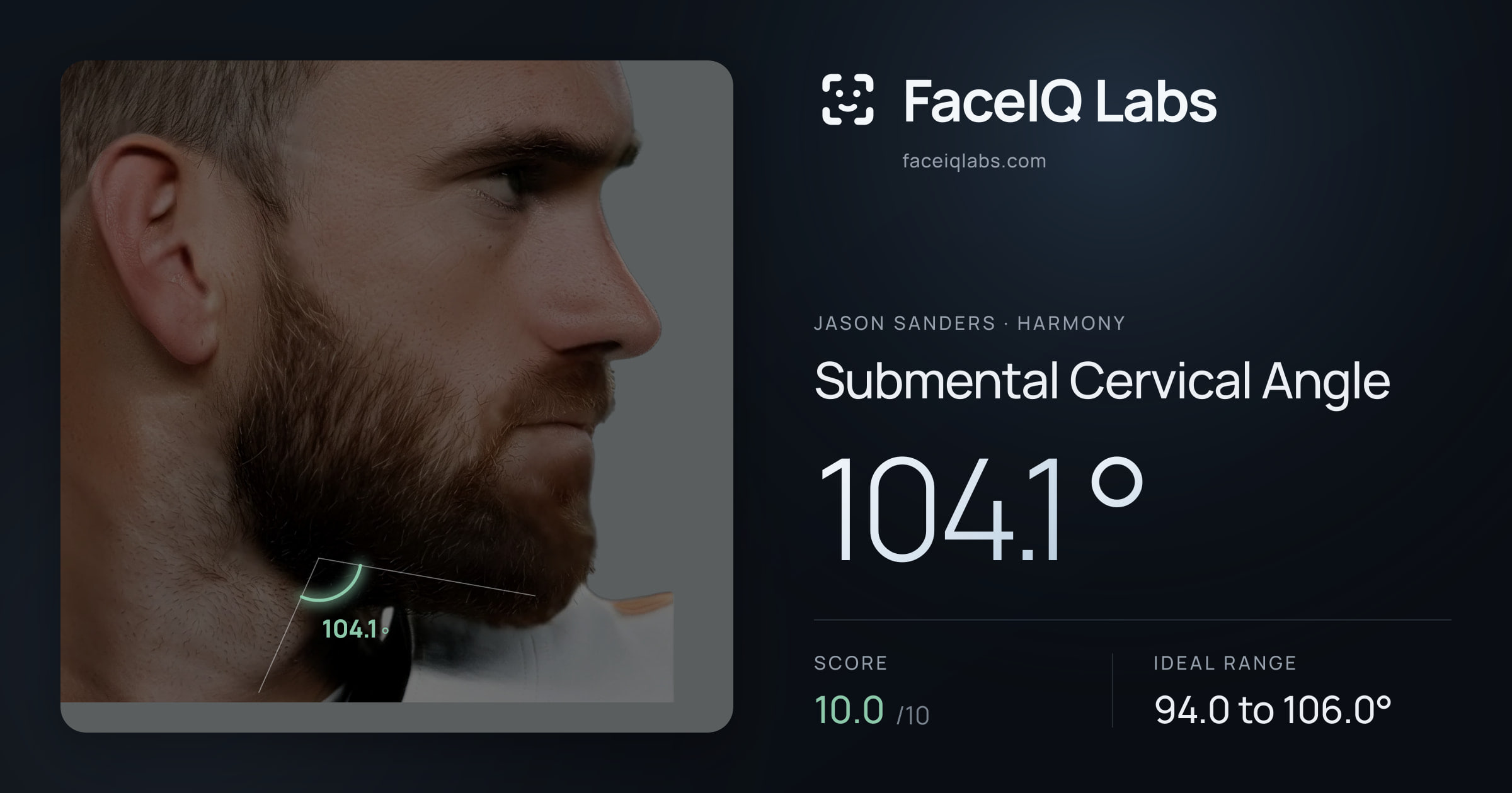 Jason Sanders Submental Cervical Angle: 104.1°, drawn on the photo
