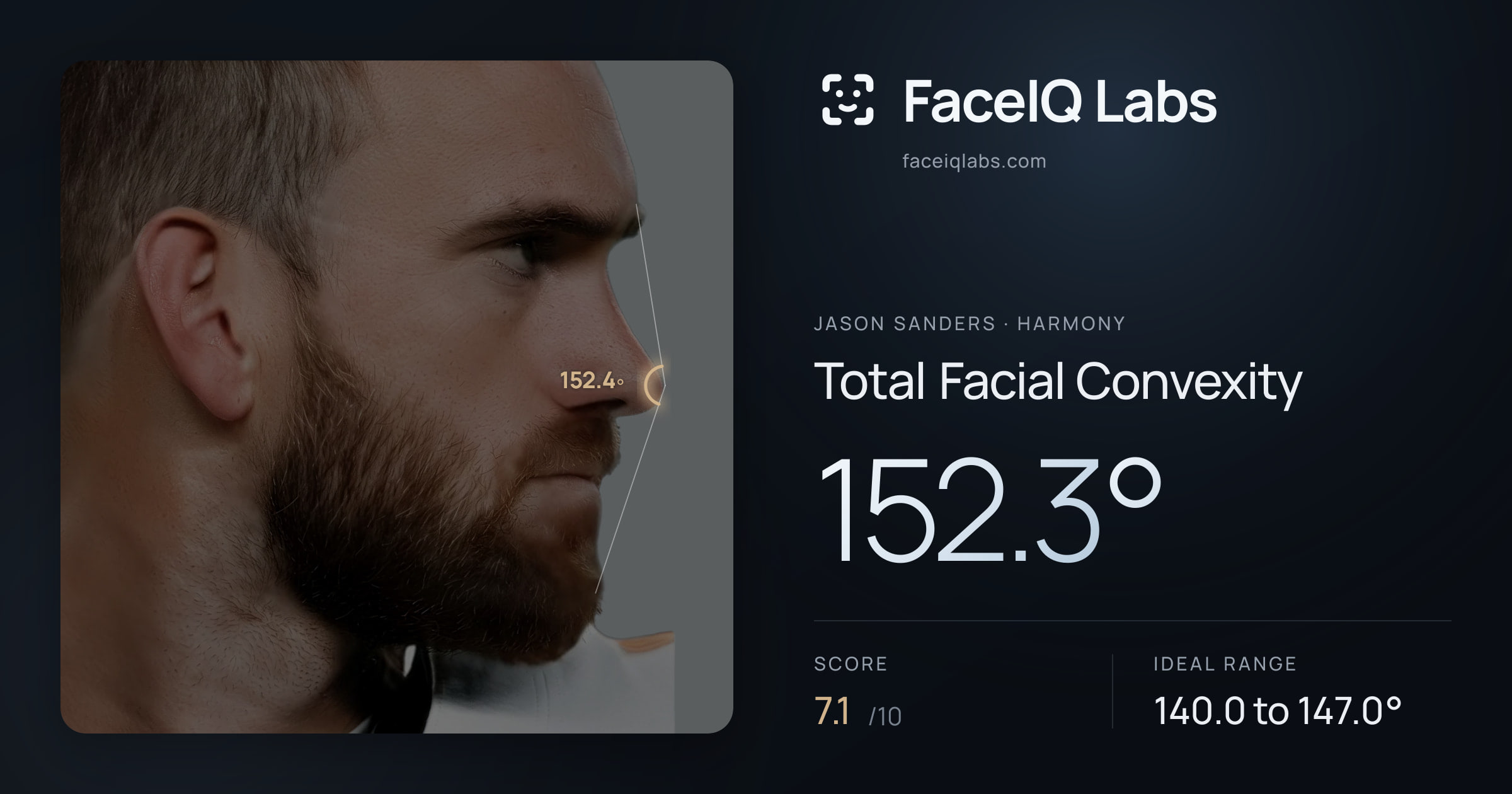 Jason Sanders Total Facial Convexity: 152.3°, drawn on the photo