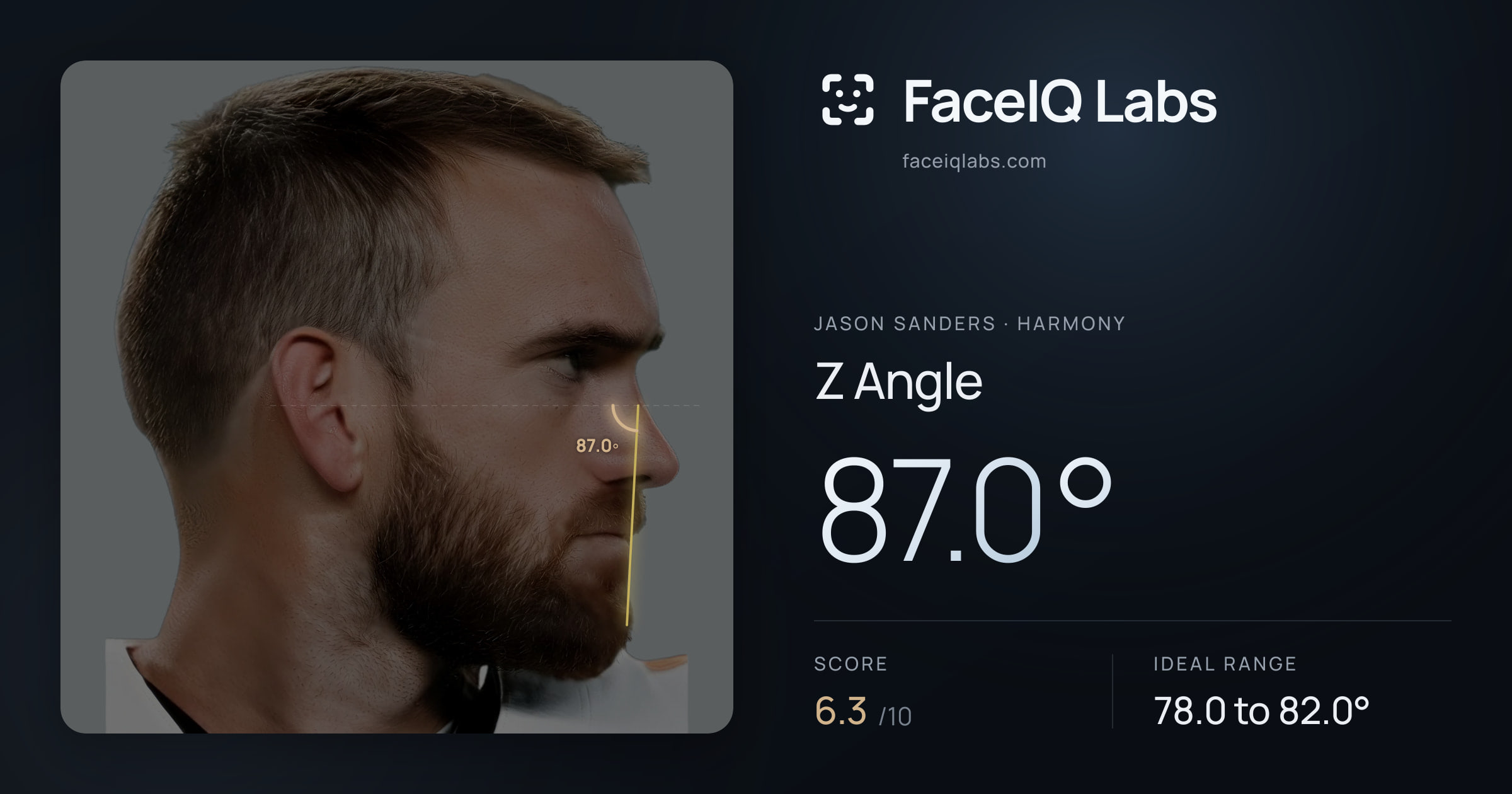 Jason Sanders Z Angle: 87.0°, drawn on the photo