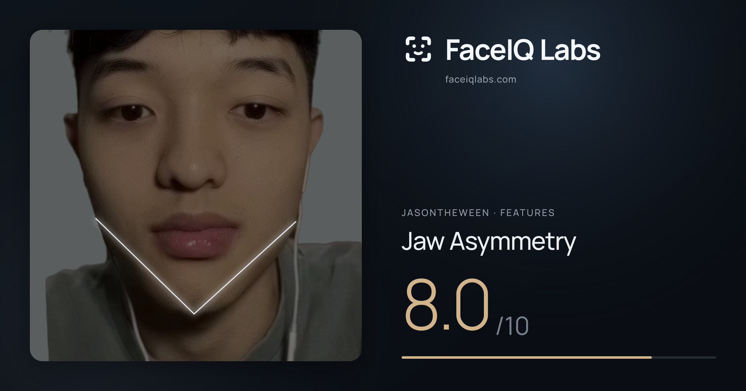 Jasontheween Jaw Asymmetry: 8.0/10, drawn on the photo