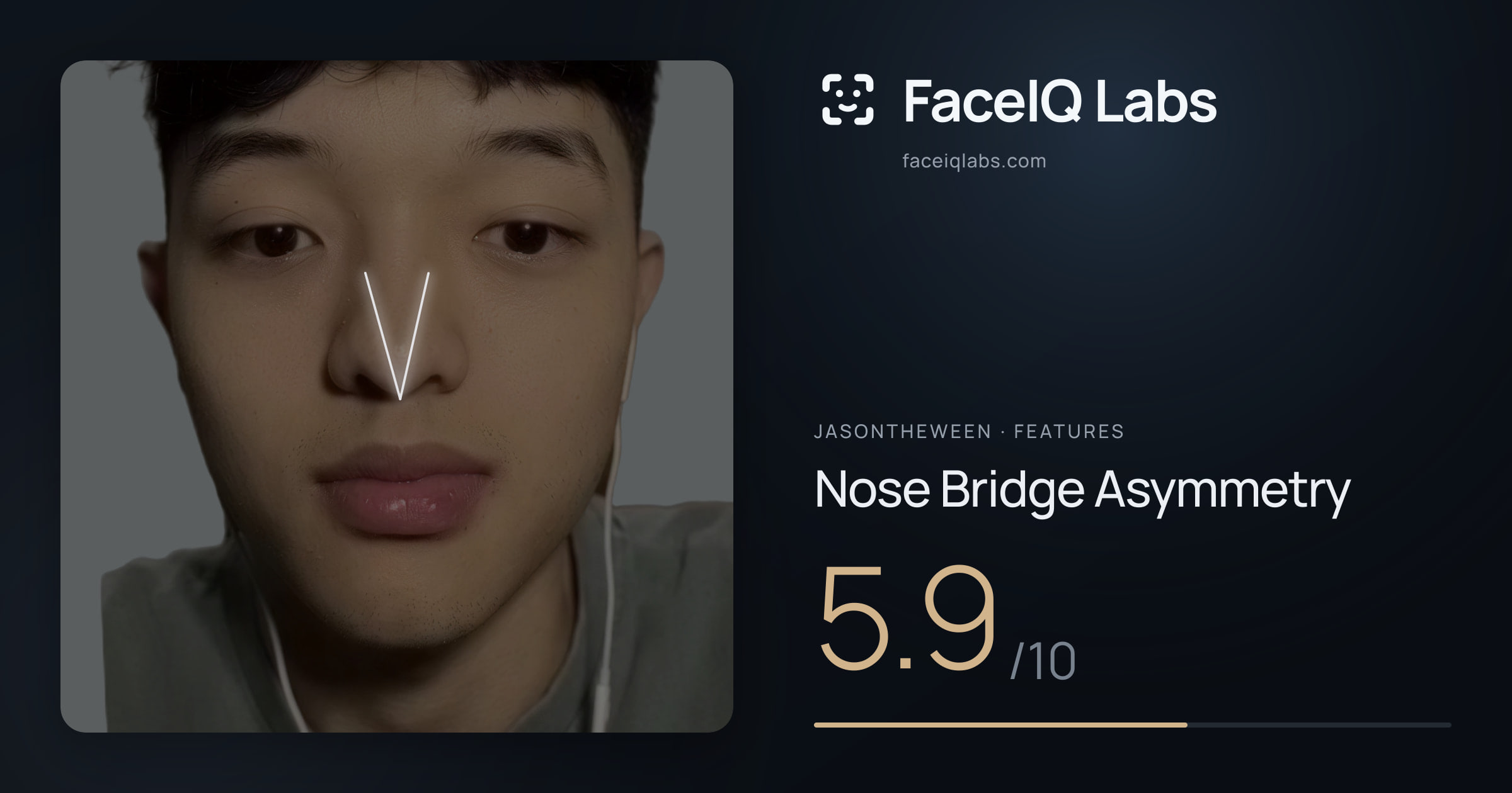 Jasontheween Nose Bridge Asymmetry: 5.9/10, drawn on the photo