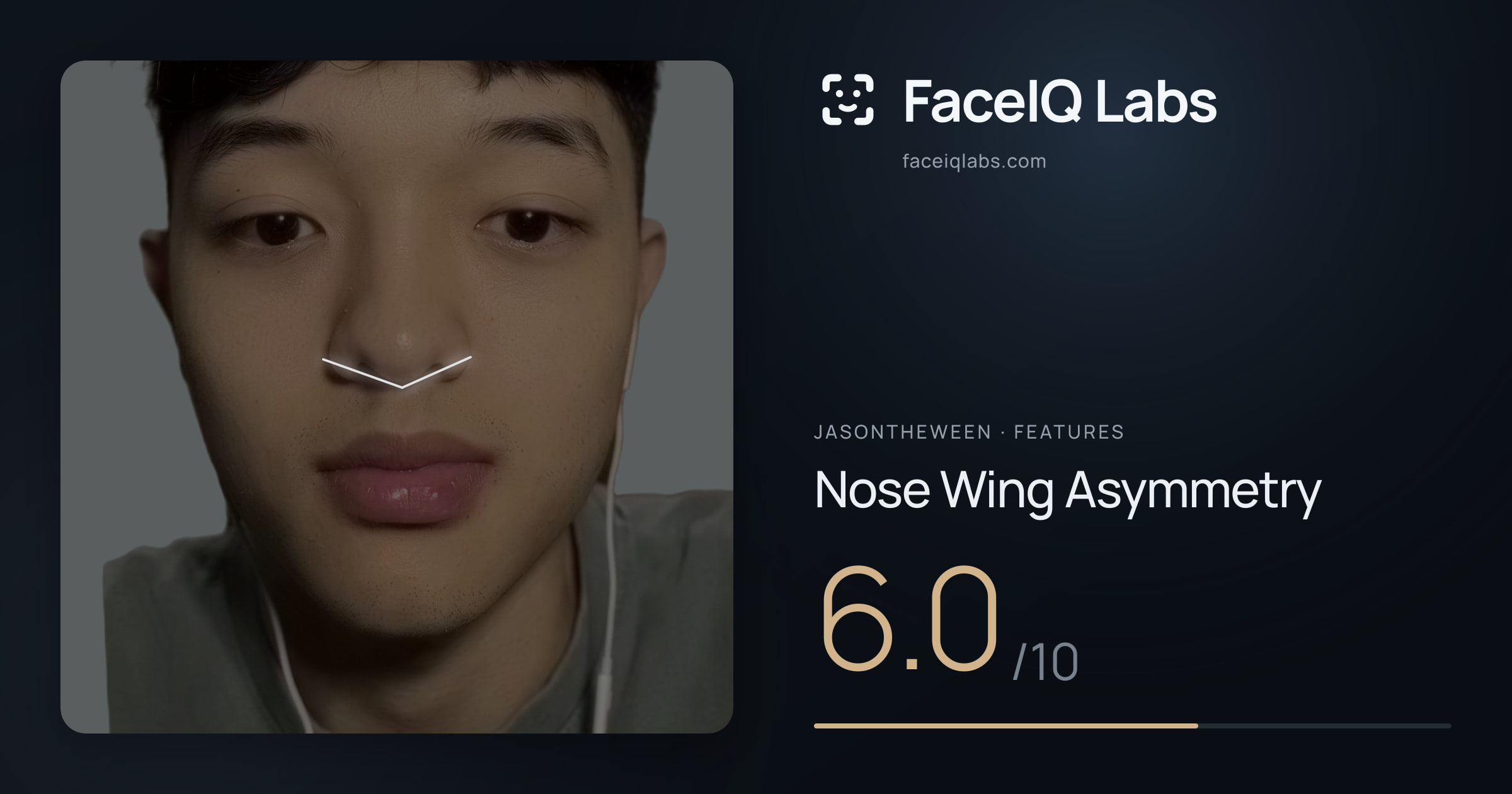 Jasontheween Nose Wing Asymmetry: 6.0/10, drawn on the photo