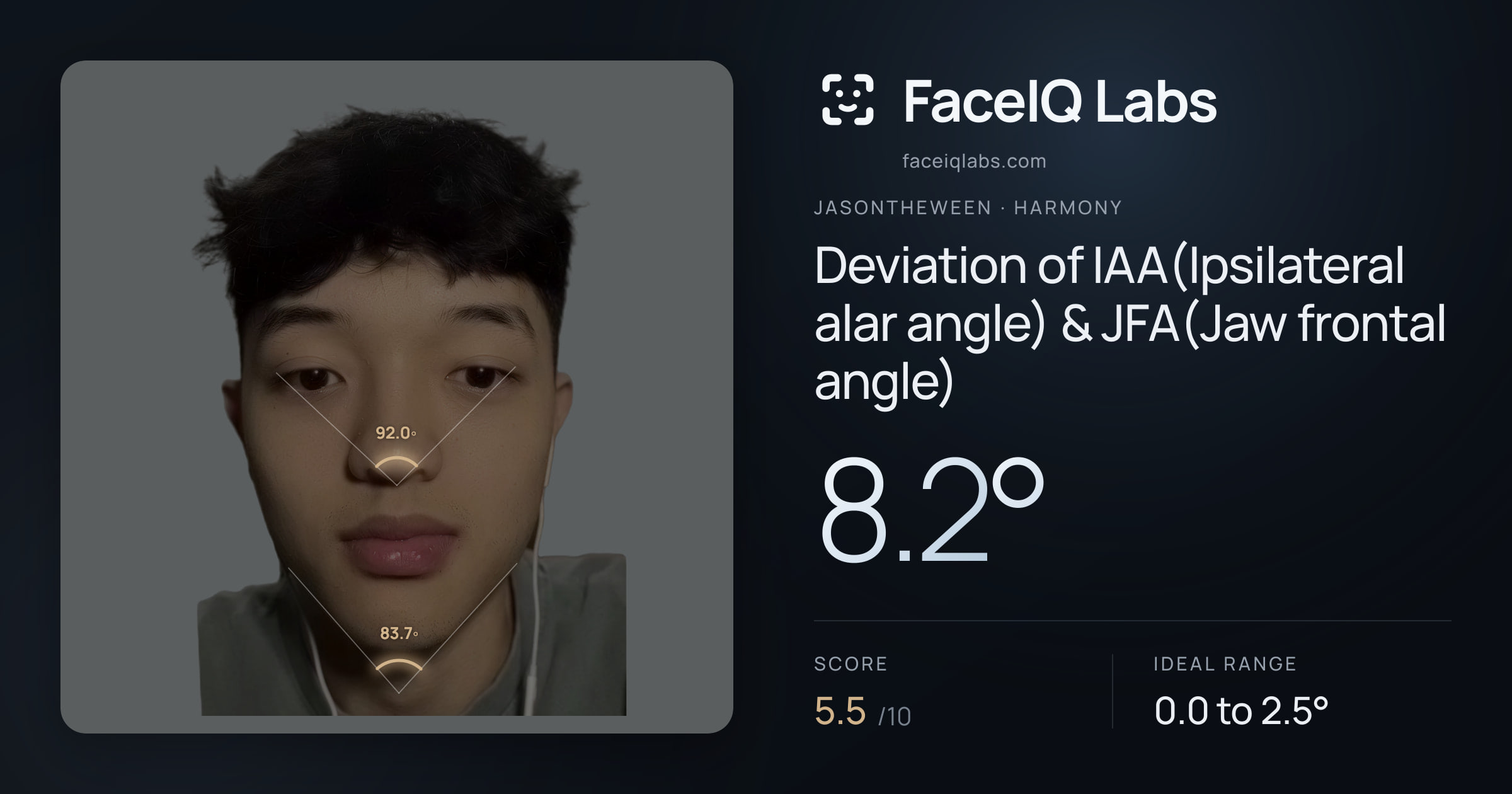 Jasontheween Deviation of IAA(Ipsilateral alar angle) & JFA(Jaw frontal angle): 8.2°, drawn on the photo